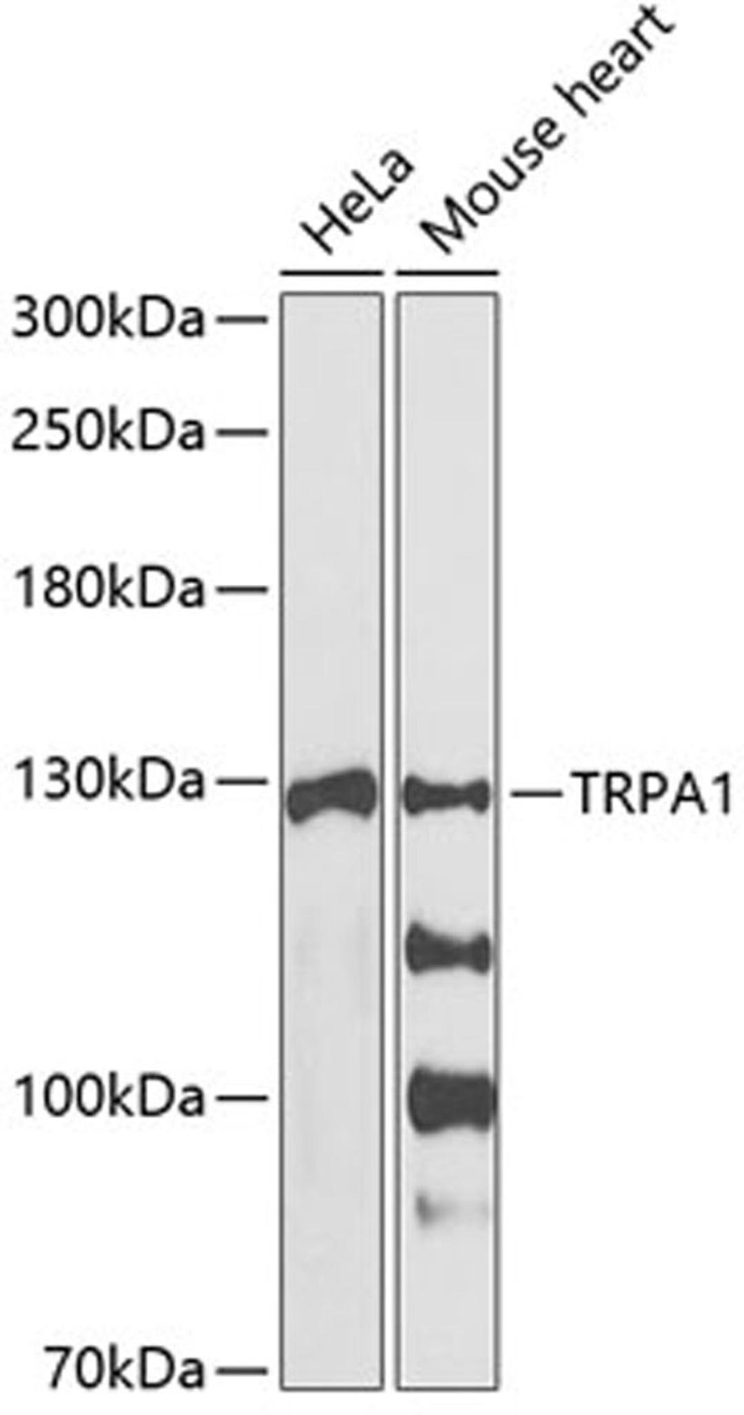 Western blot - TRPA1 antibody (A12544)