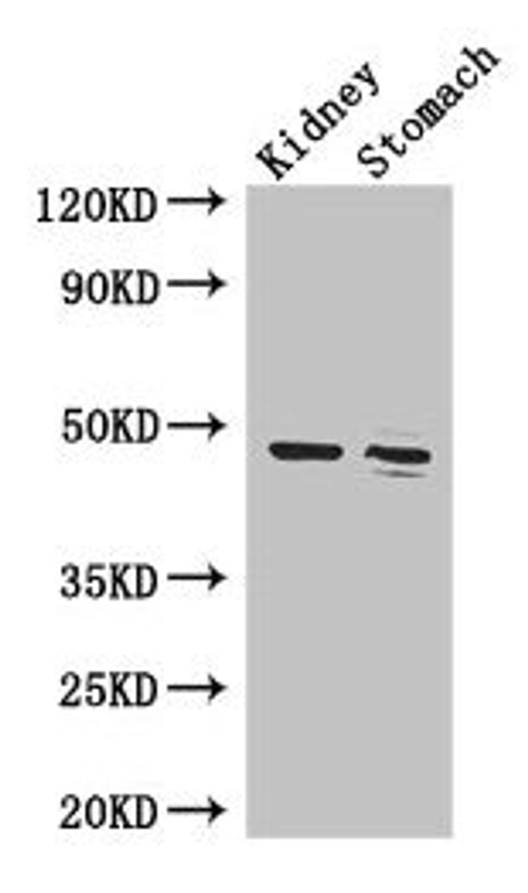 Western Blot. Positive WB detected in: Mouse kidney tissue, Mouse stomach tissue. All lanes: FAH antibody at 3.4µg/ml. Secondary. Goat polyclonal to rabbit IgG at 1/50000 dilution. Predicted band size: 47, 39 kDa. Observed band size: 47 kDa