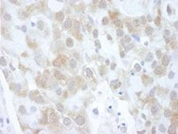 Detection of human 4EBP1 by immunohistochemistry.