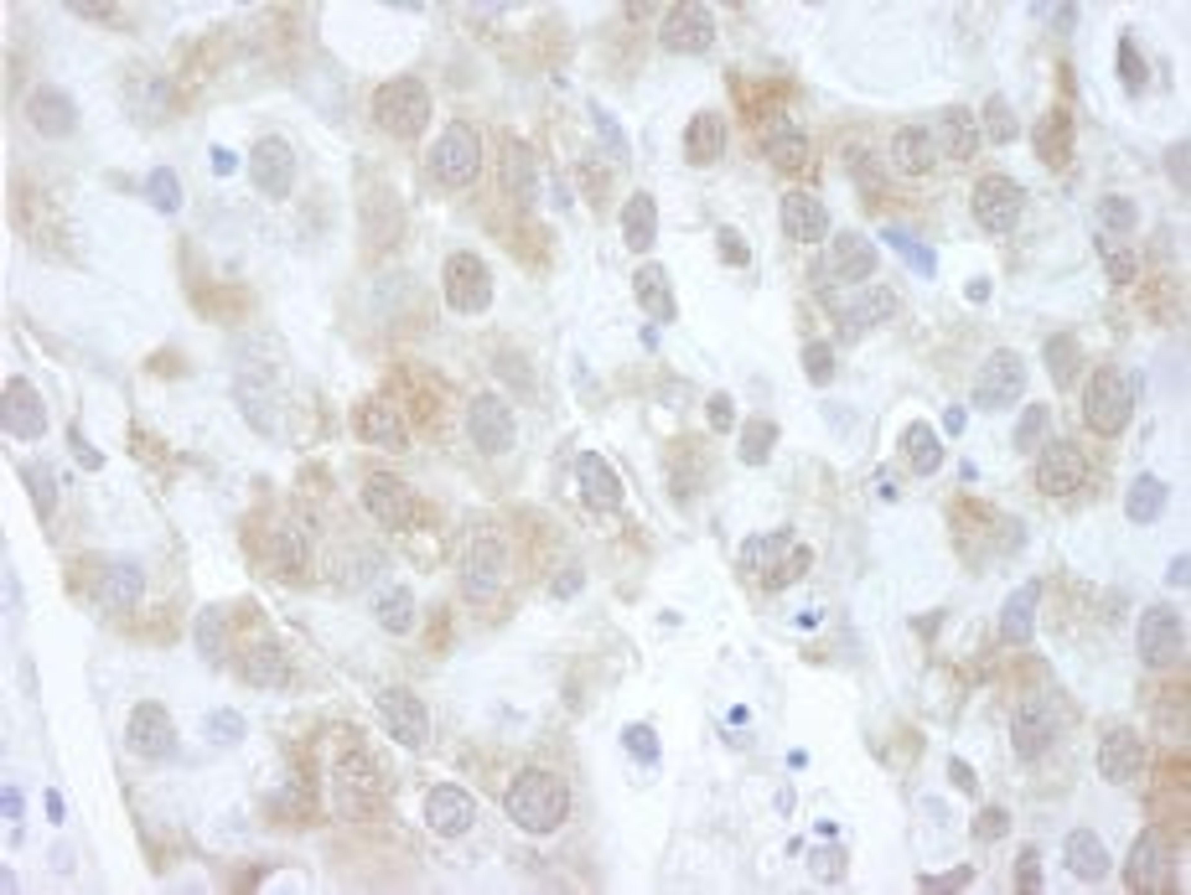 Detection of human 4EBP1 by immunohistochemistry.