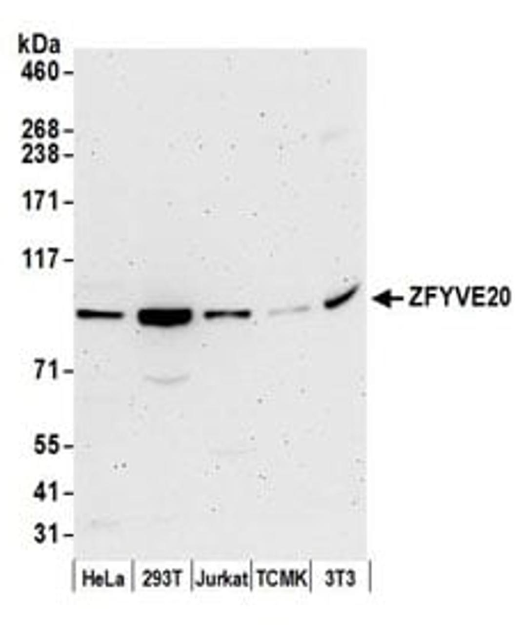 Detection of human and mouse ZFYVE20 by western blot.