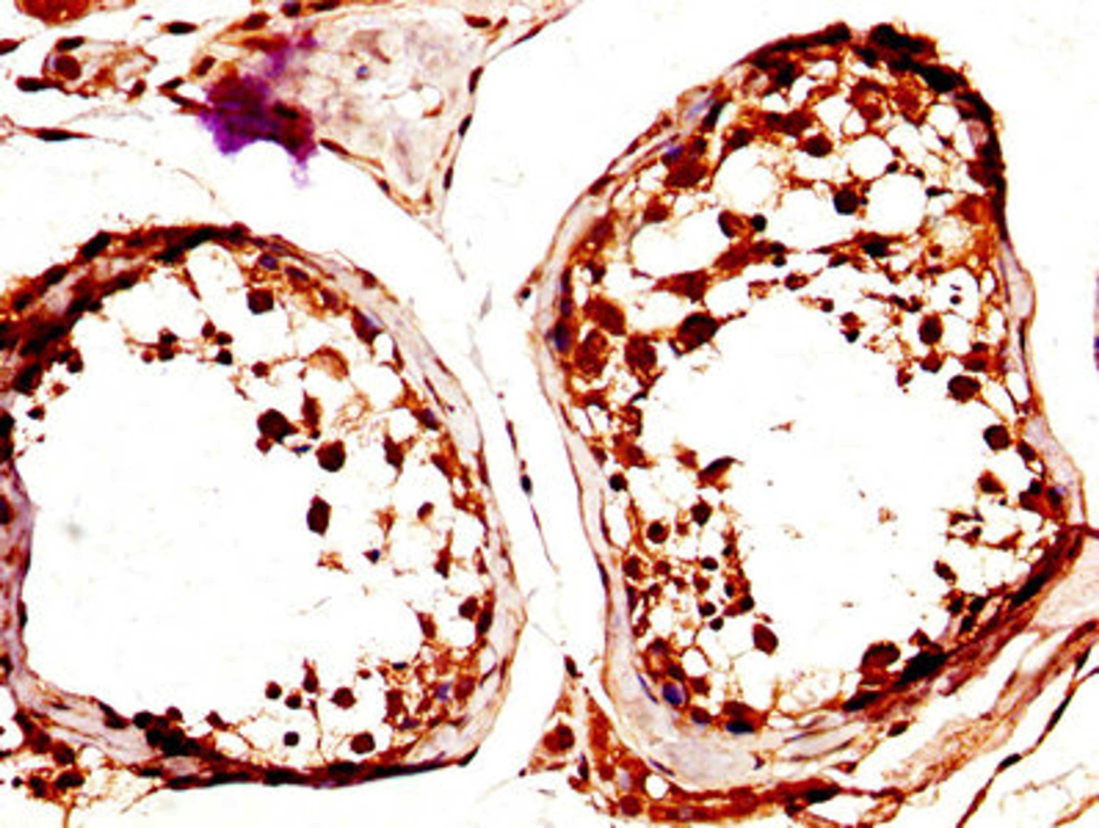 IHC image of CSB-PA891553LA01HU diluted at 1:600 and staining in paraffin-embedded human testis tissue performed on a Leica BondTM system. After dewaxing and hydration, antigen retrieval was mediated by high pressure in a citrate buffer (pH 6.0). Section was blocked with 10% normal goat serum 30min at RT. Then primary antibody (1% BSA) was incubated at 4°C overnight. The primary is detected by a biotinylated secondary antibody and visualized using an HRP conjugated SP system.