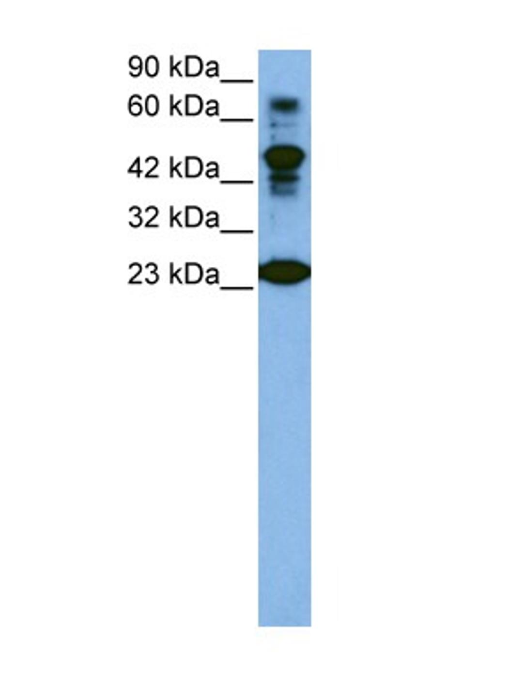 Antibody used in WB on Human Jurkat cells at 1 ug/ml.