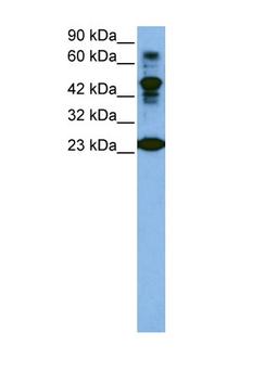 Antibody used in WB on Human Jurkat cells at 1 ug/ml.