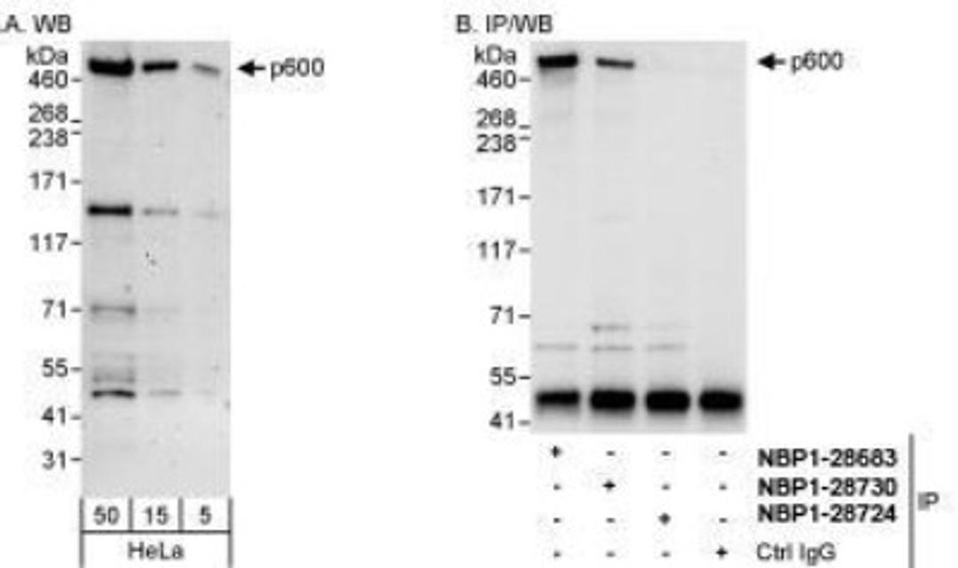 Western Blot: UBR4 Antibody [NBP1-28730] - Detection of Human p600 on HeLa whole cell lysate using NBP28730. p600 was also  immunoprecipitated by rabbit anti-p600 antibodies NBP1-28683  and NBP1-28724.