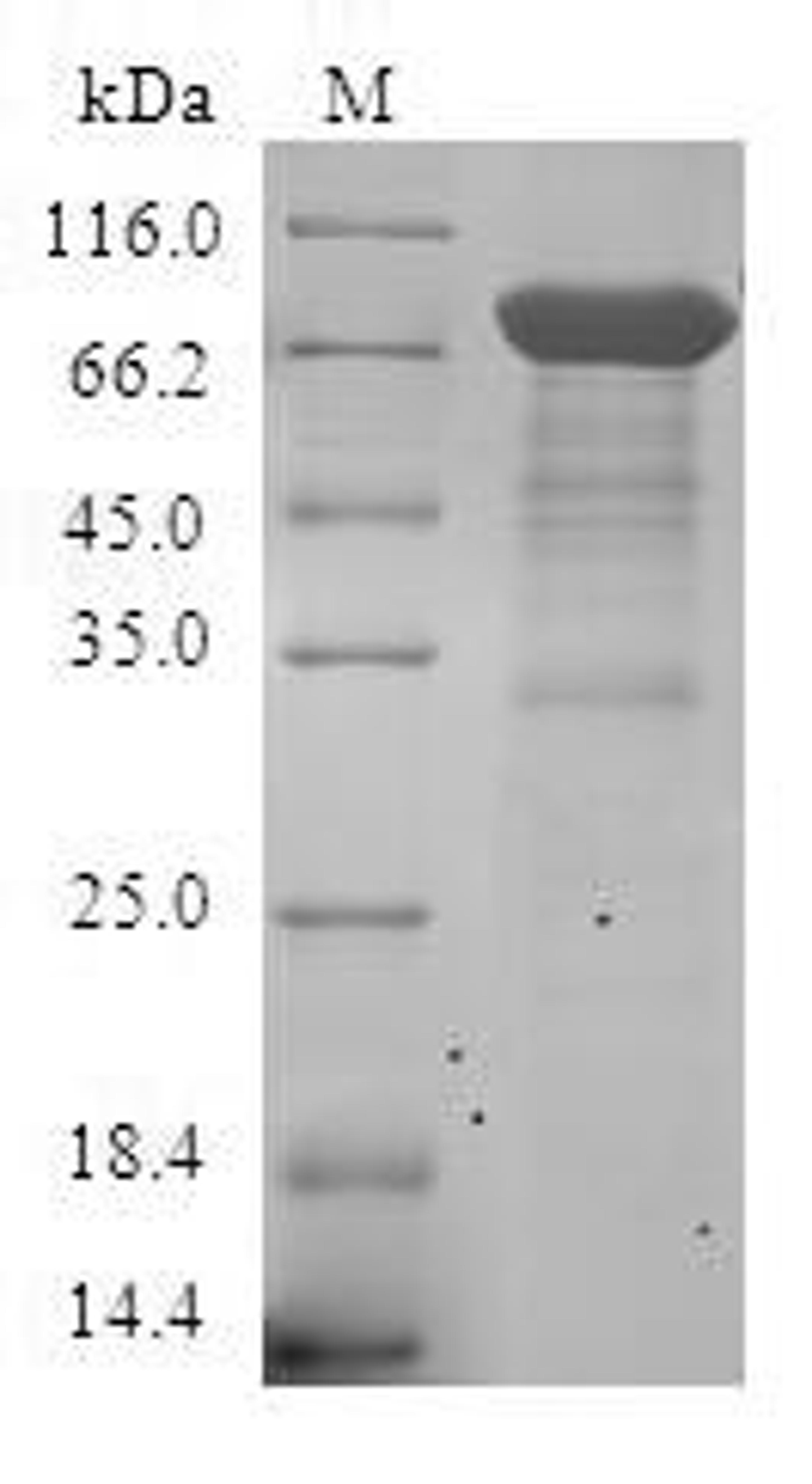 (Tris-Glycine gel) Discontinuous SDS-PAGE (reduced) with 5% enrichment gel and 15% separation gel.