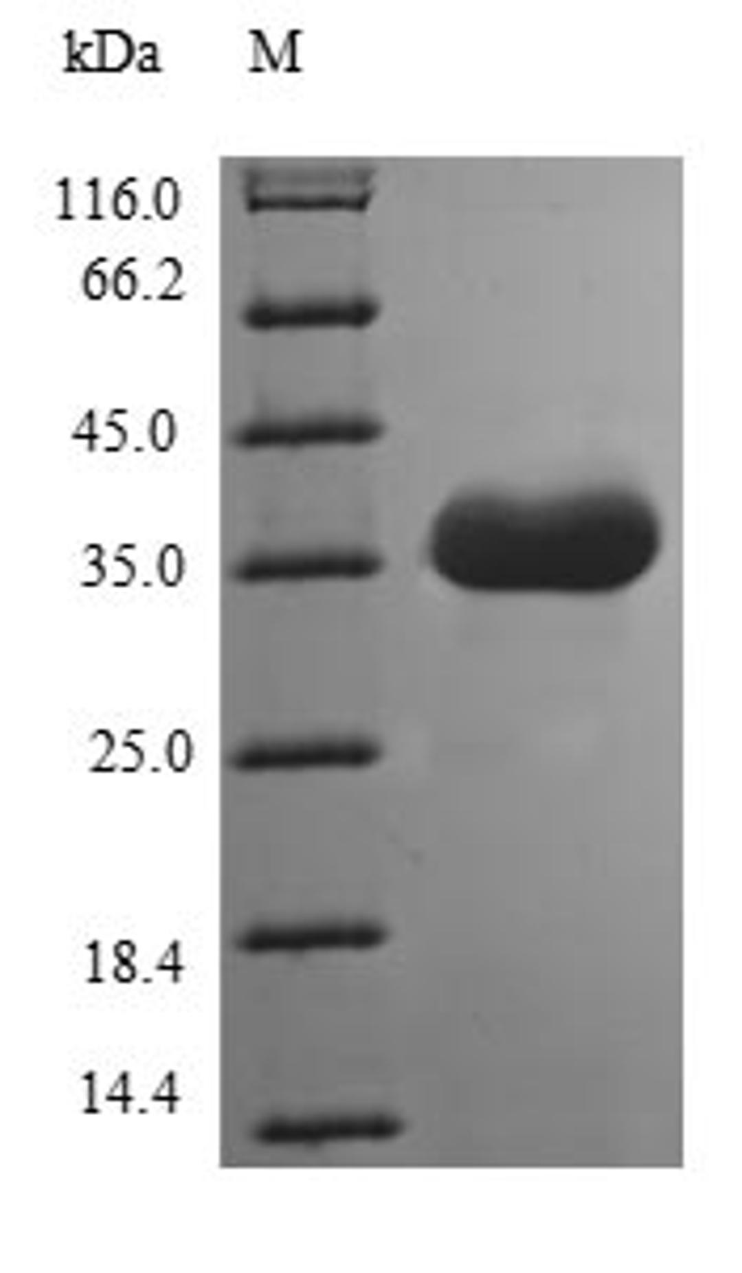 (Tris-Glycine gel) Discontinuous SDS-PAGE (reduced) with 5% enrichment gel and 15% separation gel.
