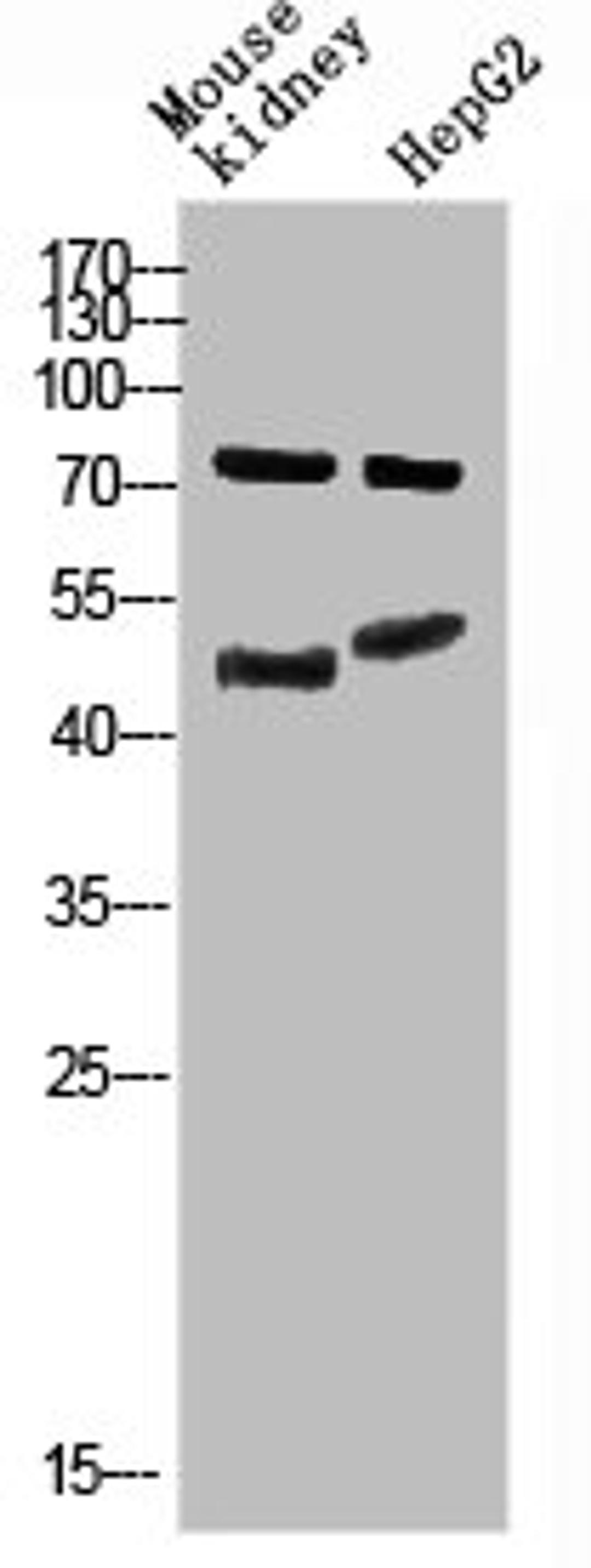 Western Blot analysis of mouse-kidney, hepg2 cells using Antibody diluted at 800. Secondary antibody  was diluted at 1:20000