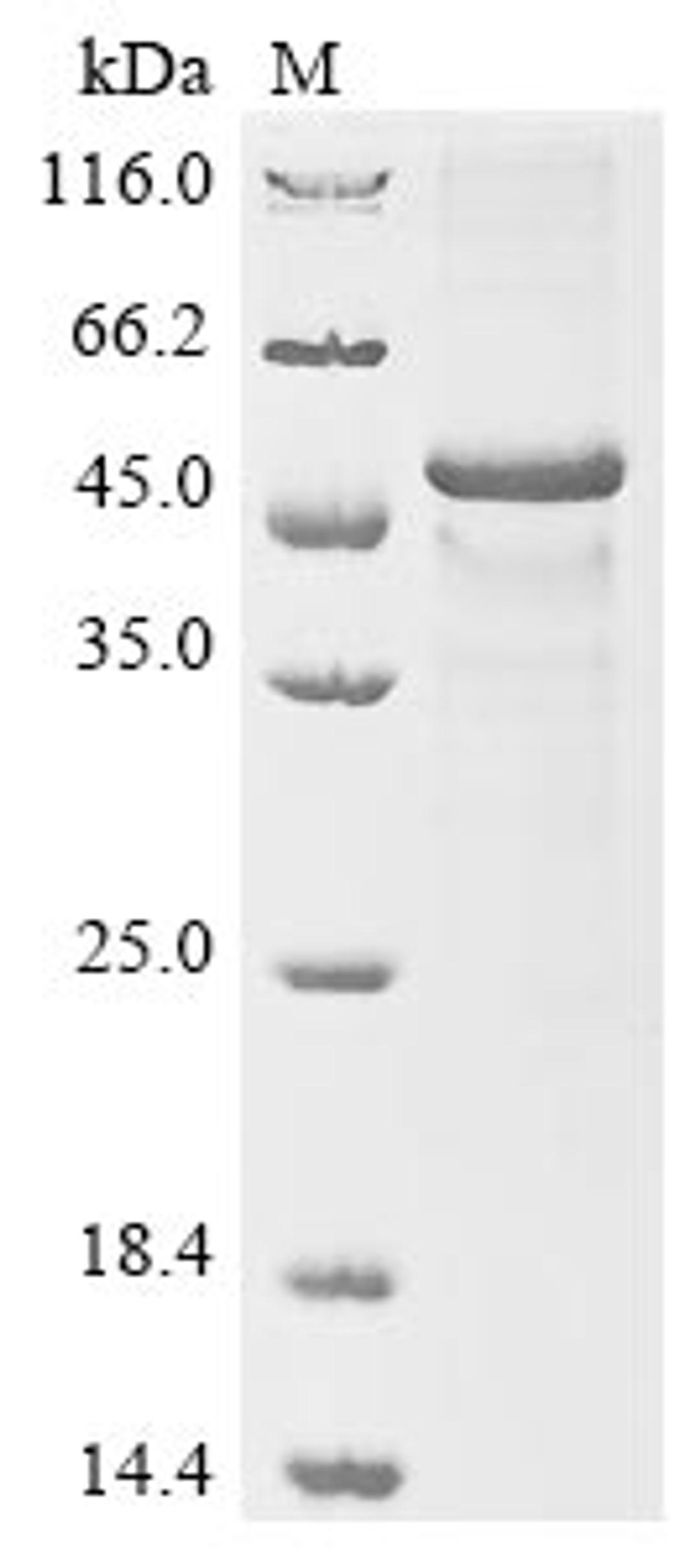 (Tris-Glycine gel) Discontinuous SDS-PAGE (reduced) with 5% enrichment gel and 15% separation gel.
