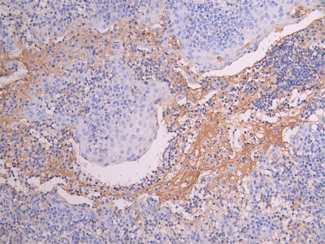 IHC image of CSB-RA014679MA1HU diluted at 1:150 and staining in paraffin-embedded human tonsil tissue performed on a Leica BondTM system. After dewaxing and hydration, antigen retrieval was mediated by high pressure in a citrate buffer (pH 6.0). Section was blocked with 10% normal goat serum 30min at RT. Then primary antibody (1% BSA) was incubated at 4°C overnight. The primary is detected by a Goat anti-human polymer IgG labeled by HRP and visualized using 0.05% DAB.