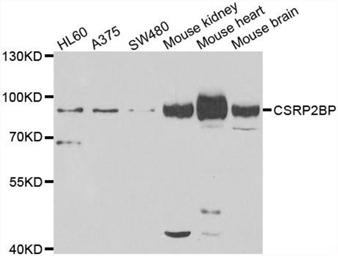 Western blot analysis of extracts of various cell lines using CSRP2BP antibody