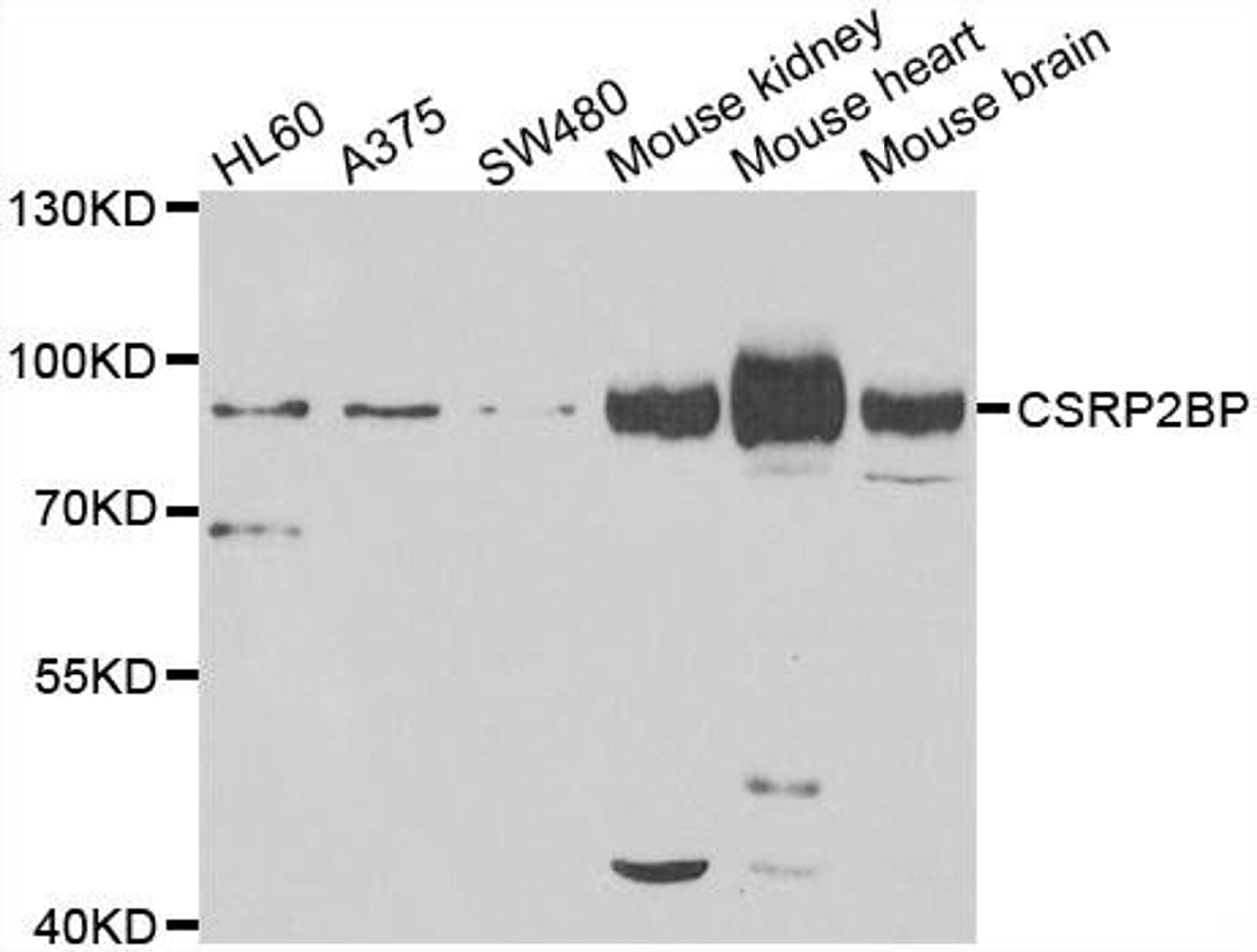 Western blot analysis of extracts of various cell lines using CSRP2BP antibody