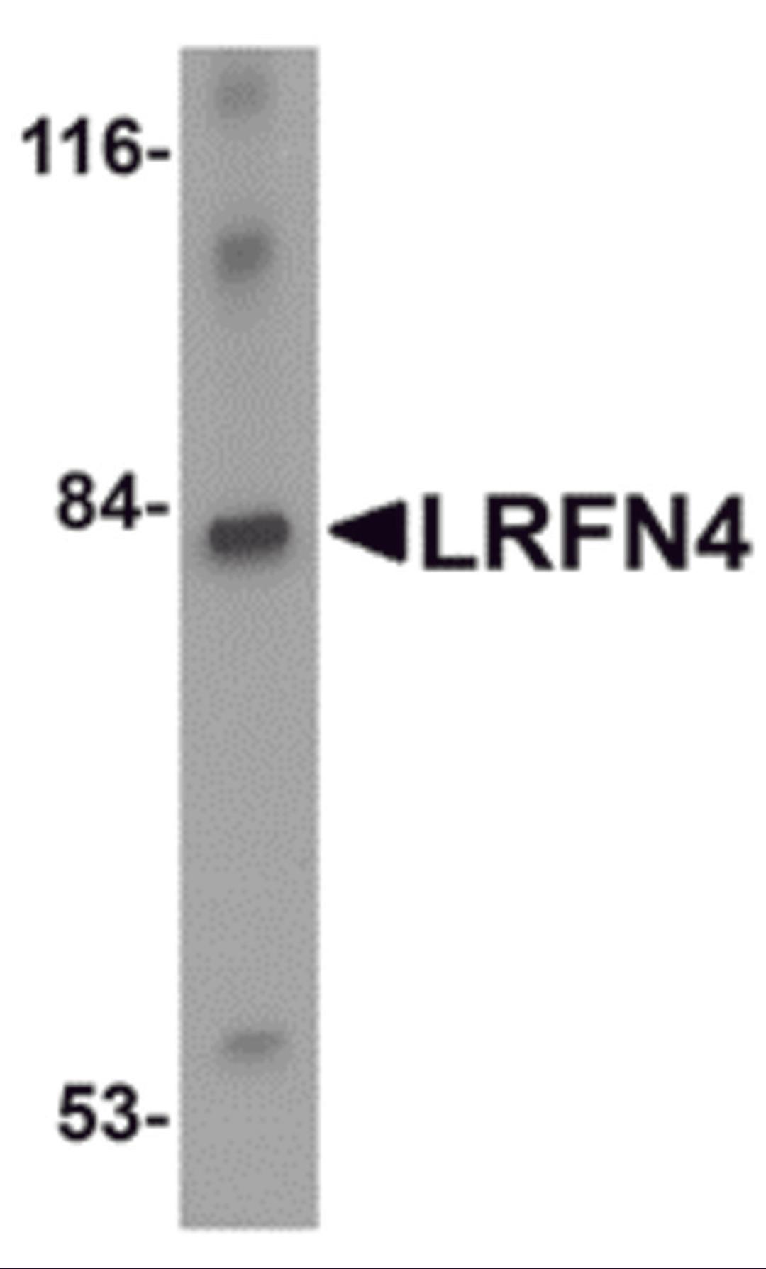 Western blot analysis of LRFN4 in rat brain lysate with LRFN4 antibody at 1 &#956;g/mL.