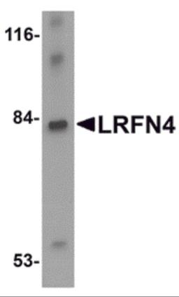 Western blot analysis of LRFN4 in rat brain lysate with LRFN4 antibody at 1 μg/mL.