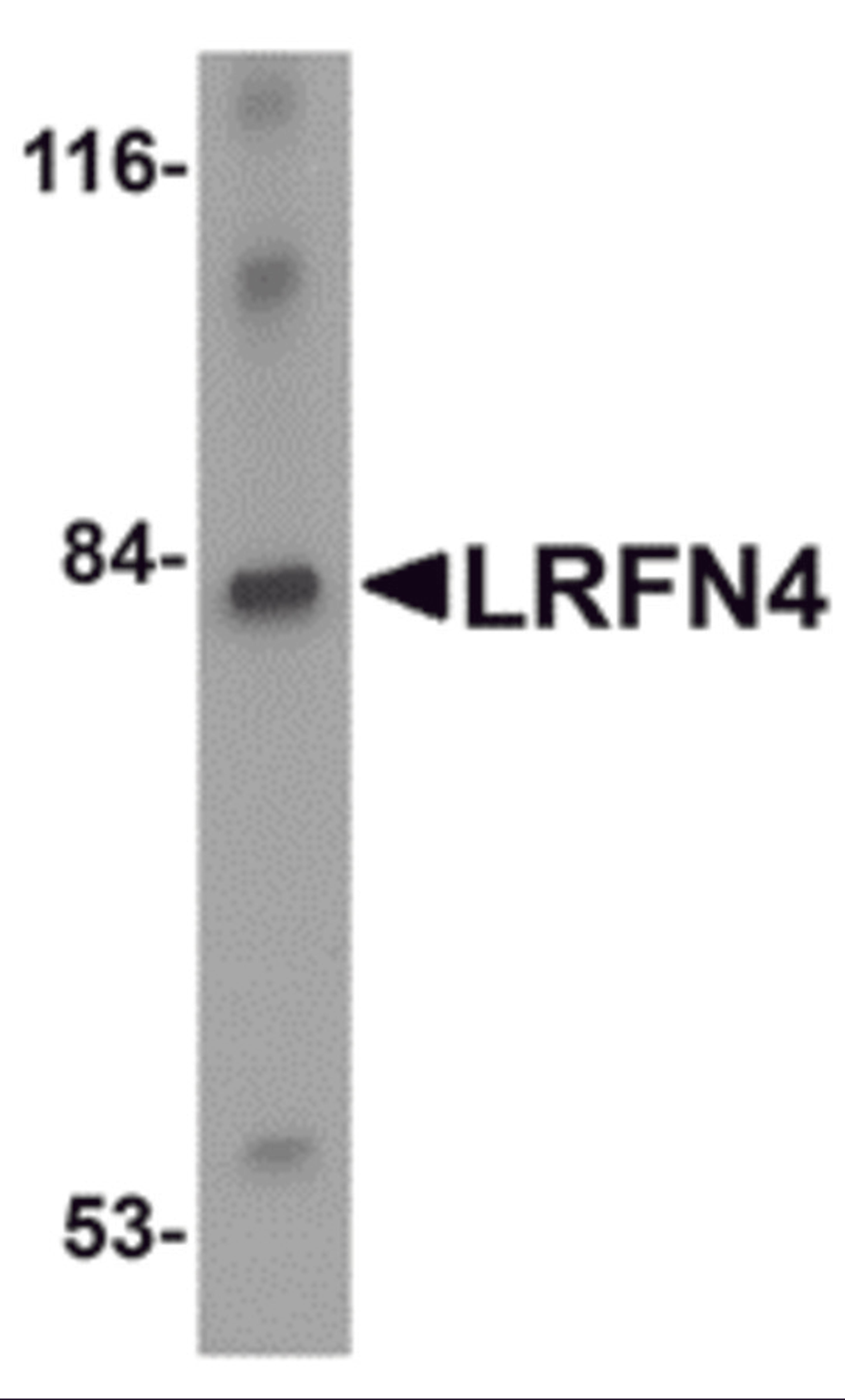 Western blot analysis of LRFN4 in rat brain lysate with LRFN4 antibody at 1 μg/mL.