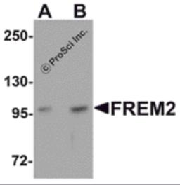 Western blot analysis of FREM2 in A-20 cell lysate with FREM2 antibody at (A) 0.5 and (B) 1&#956;g/mL.