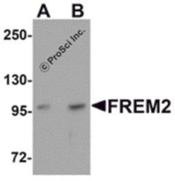 Western blot analysis of FREM2 in A-20 cell lysate with FREM2 antibody at (A) 0.5 and (B) 1μg/mL.