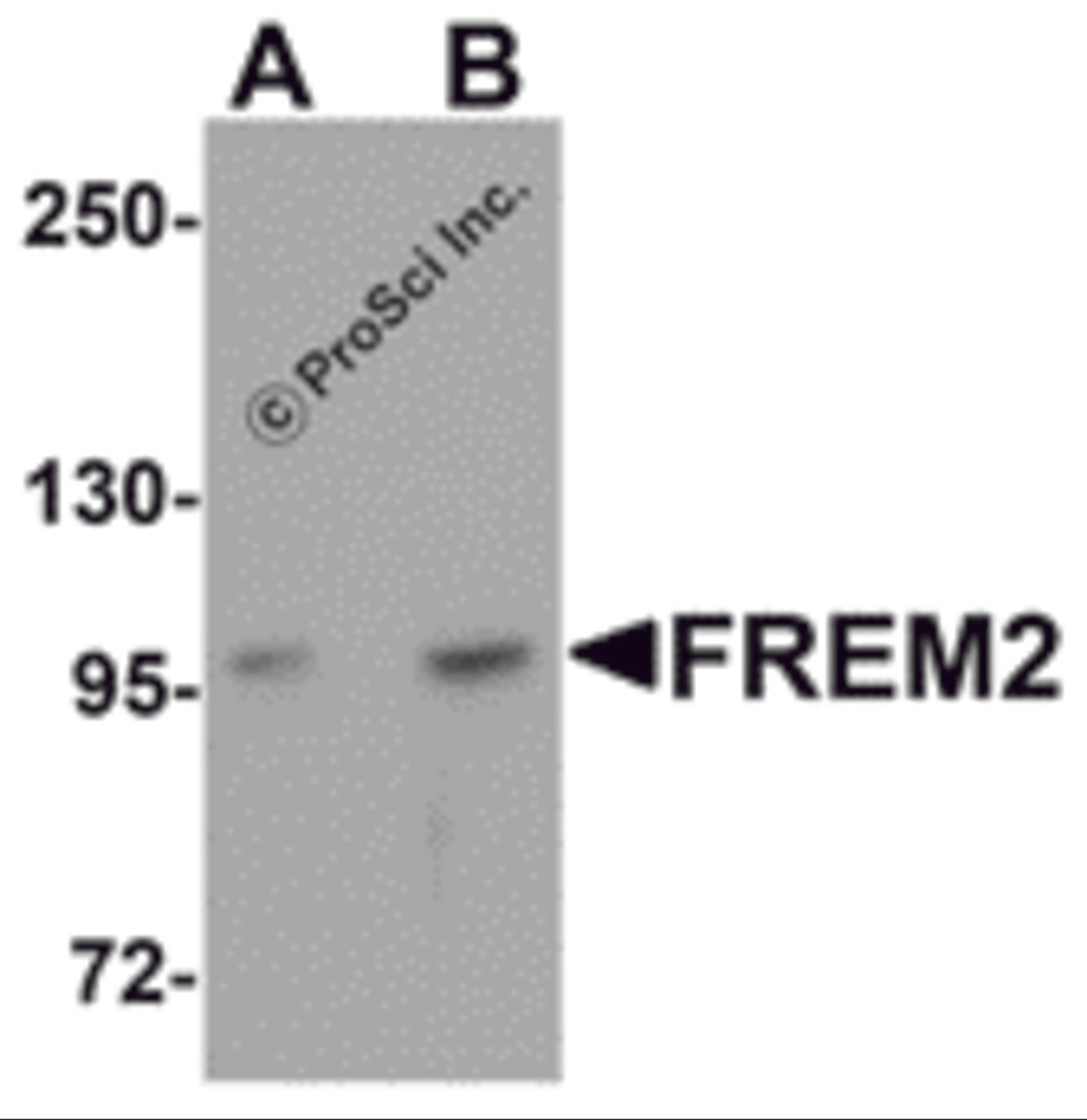 Western blot analysis of FREM2 in A-20 cell lysate with FREM2 antibody at (A) 0.5 and (B) 1μg/mL.