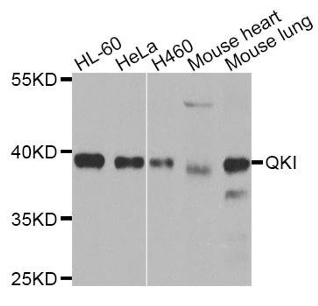 WB analysis of extracts of various cell lines using QKI antibody