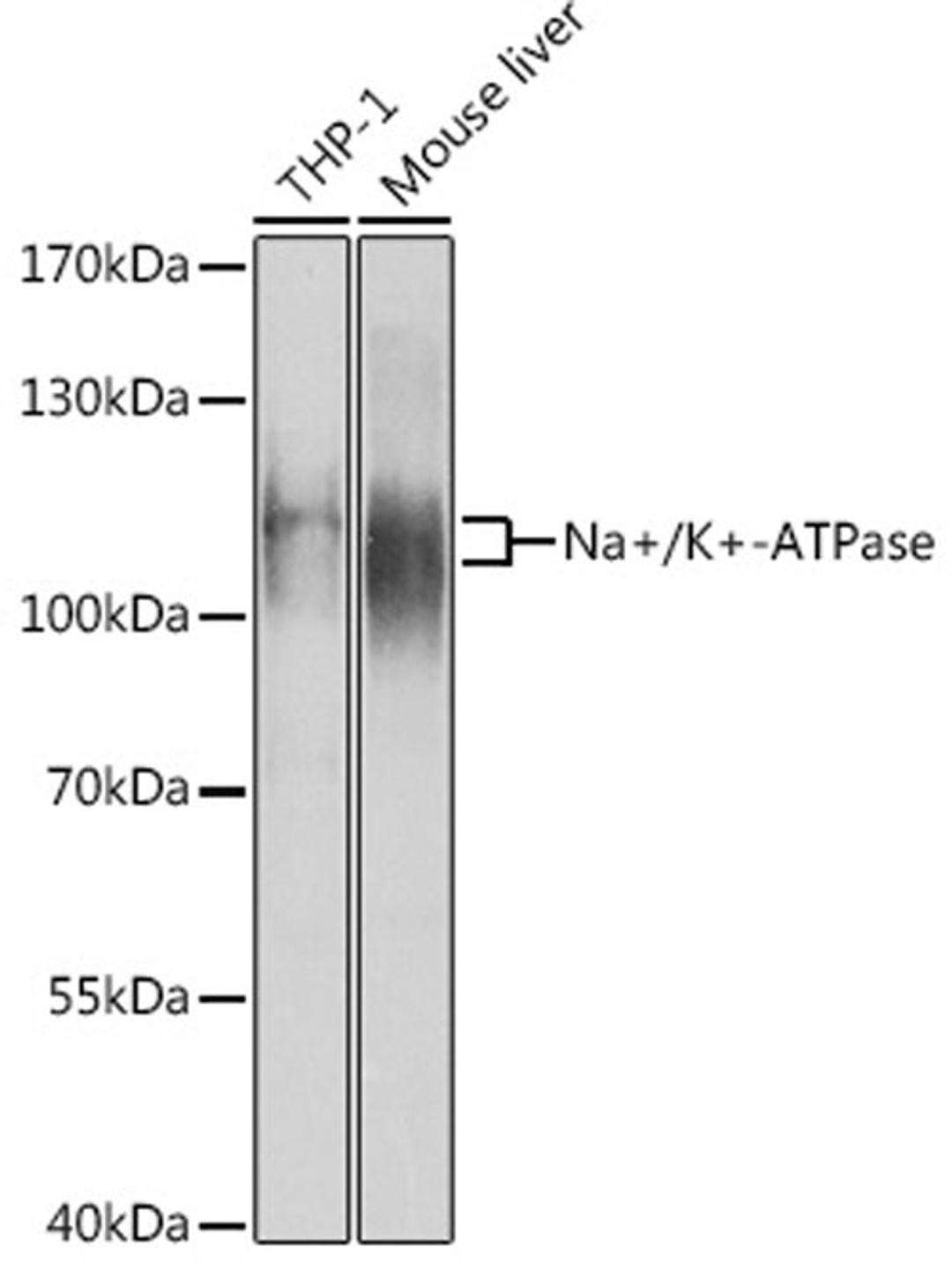 Western blot - Na+/K+-ATPase1 antibody (A12405)