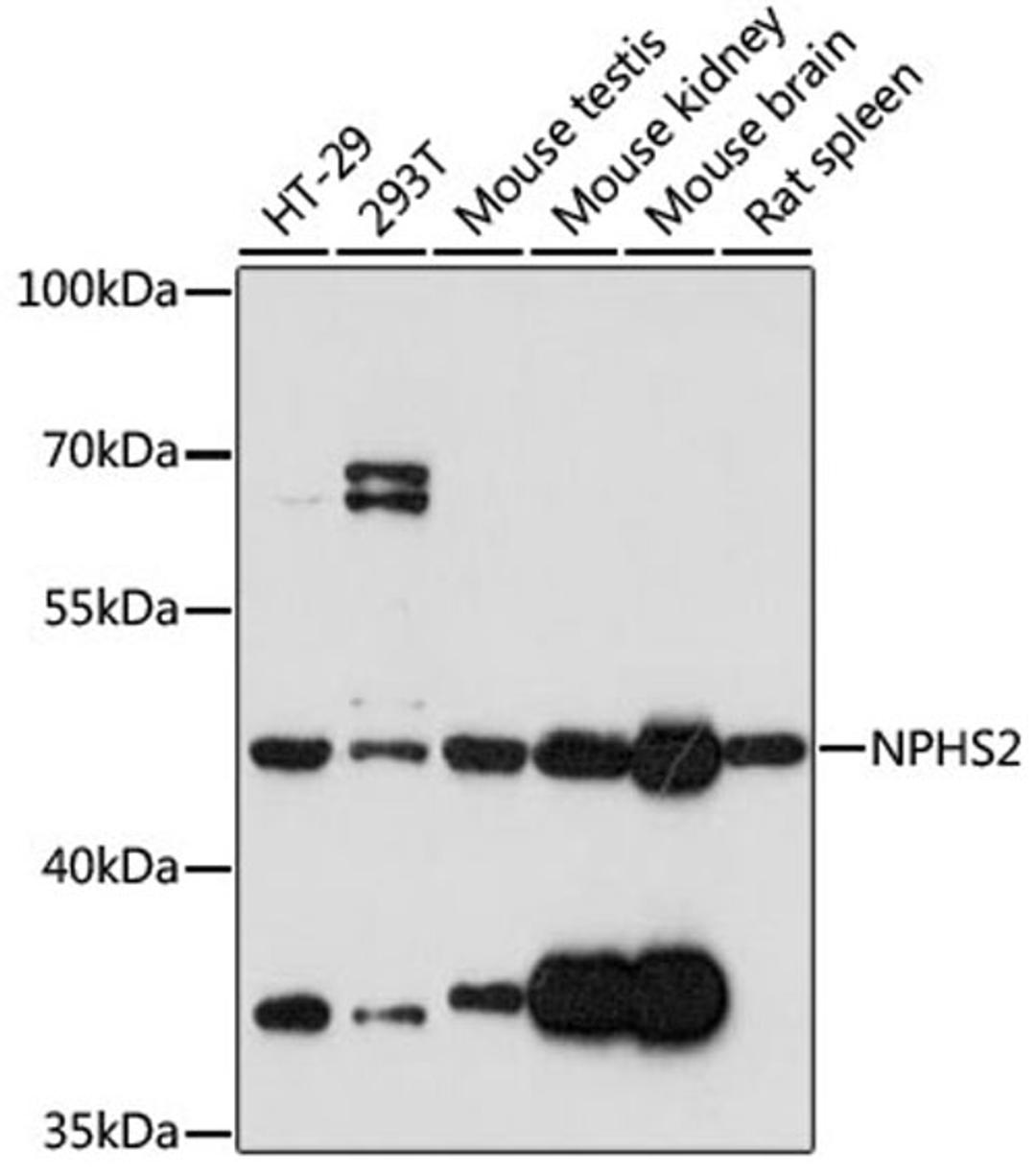 Western blot - NPHS2 antibody (A17337)