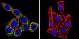 Immunocytochemistry/Immunofluorescence: Sodium Potassium ATPase Alpha 3 Antibody (XVIF9-G10) [NB300-540] - Sodium/Potassium ATPase alpha-3 staining (green), F-Actin staining with Phalloidin (red) and nuclei with DAPI (blue) in HeLa cells is shown. Cells were grown on chamber slides and fixed with formaldehyde prior to staining. Cells were probed without (control) or with or an antibody recognizing Sodium/Potassium ATPase alpha-3 at a dilution of 1:20 over night at 4C, washed with PBS and incubated with a DyLight-488 conjugated.