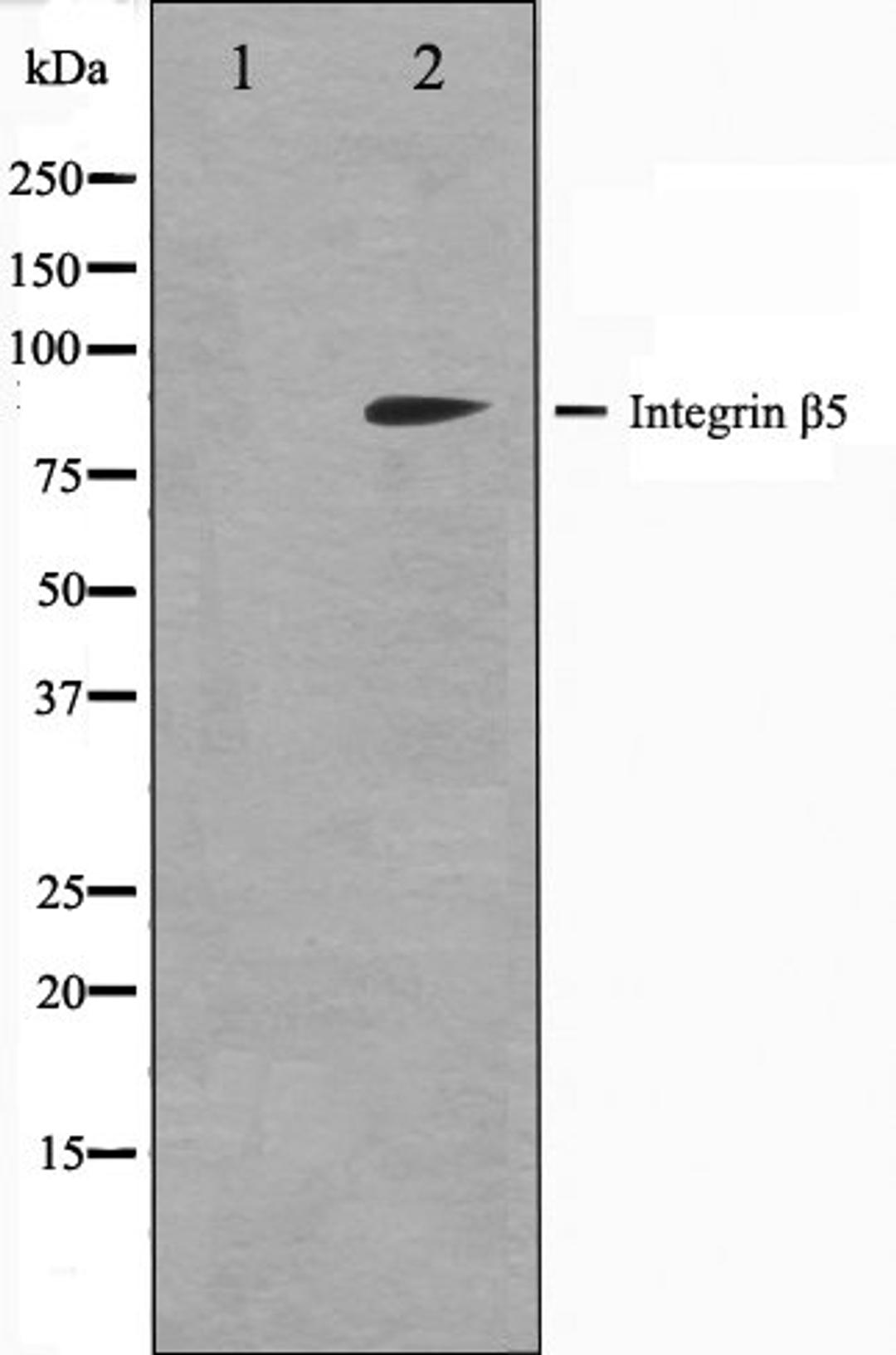 Western blot analysis of COS7 cell lysate using Integrin beta-5 antibody