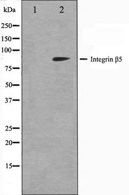 Western blot analysis of COS7 cell lysate using Integrin beta-5 antibody