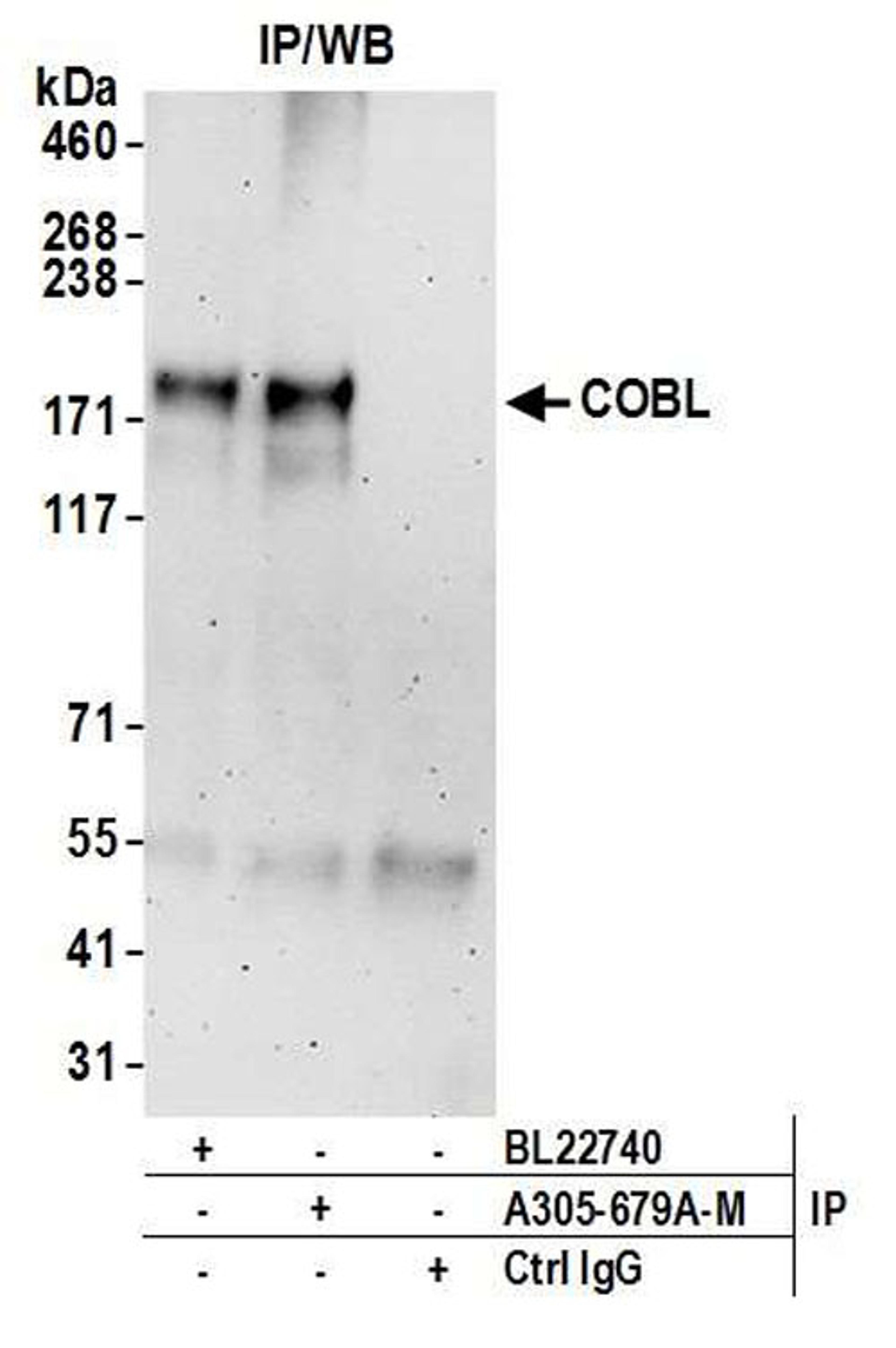 Detection of human COBL by WB of IP.