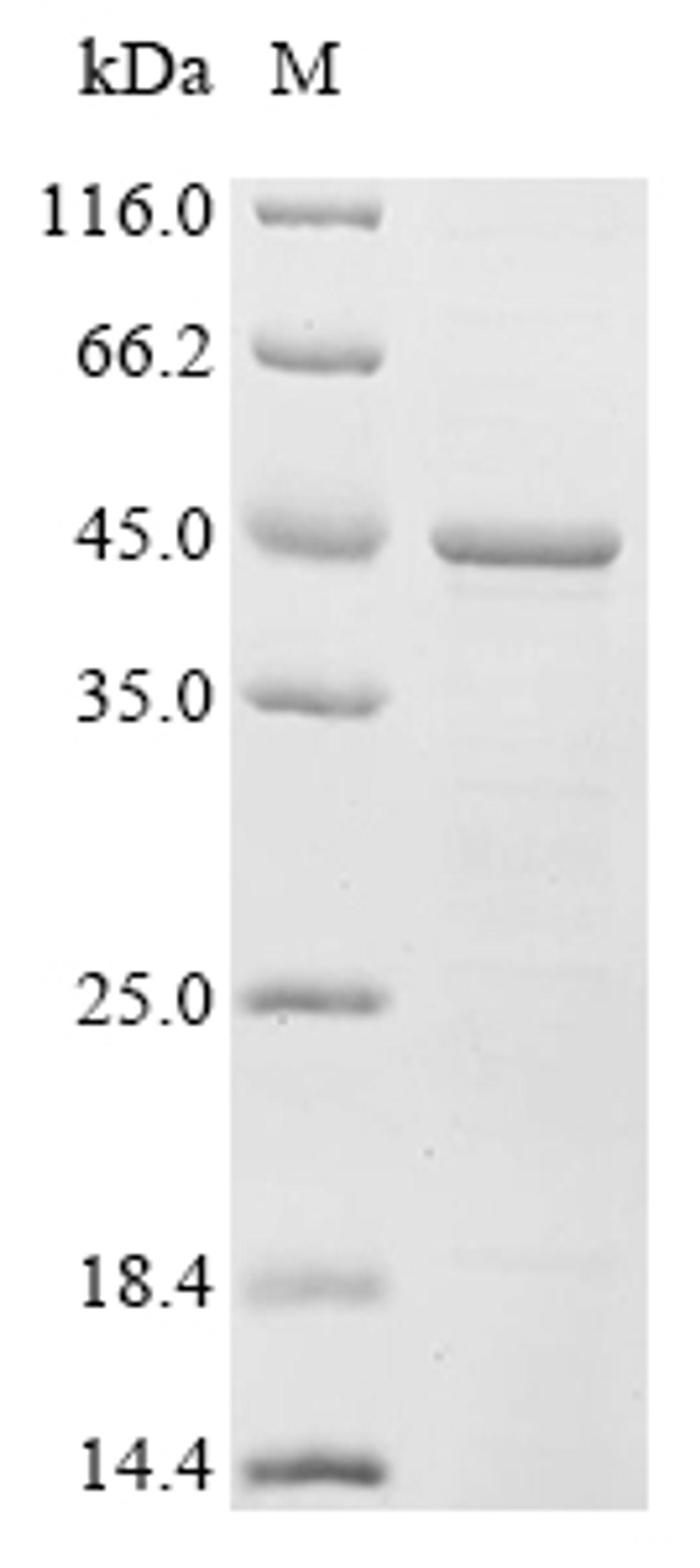 (Tris-Glycine gel) Discontinuous SDS-PAGE (reduced) with 5% enrichment gel and 15% separation gel.