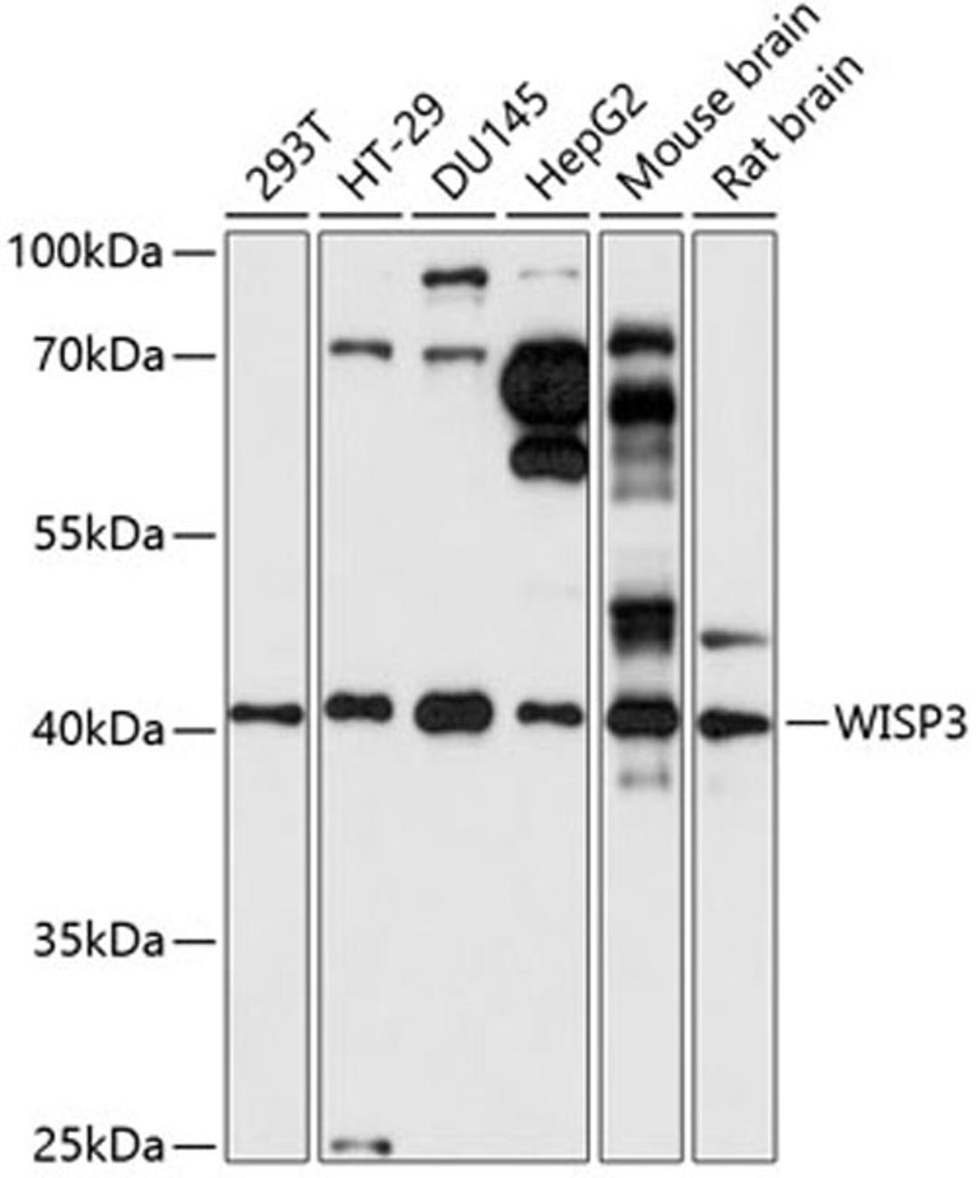 Western blot - WISP3 antibody (A14812)