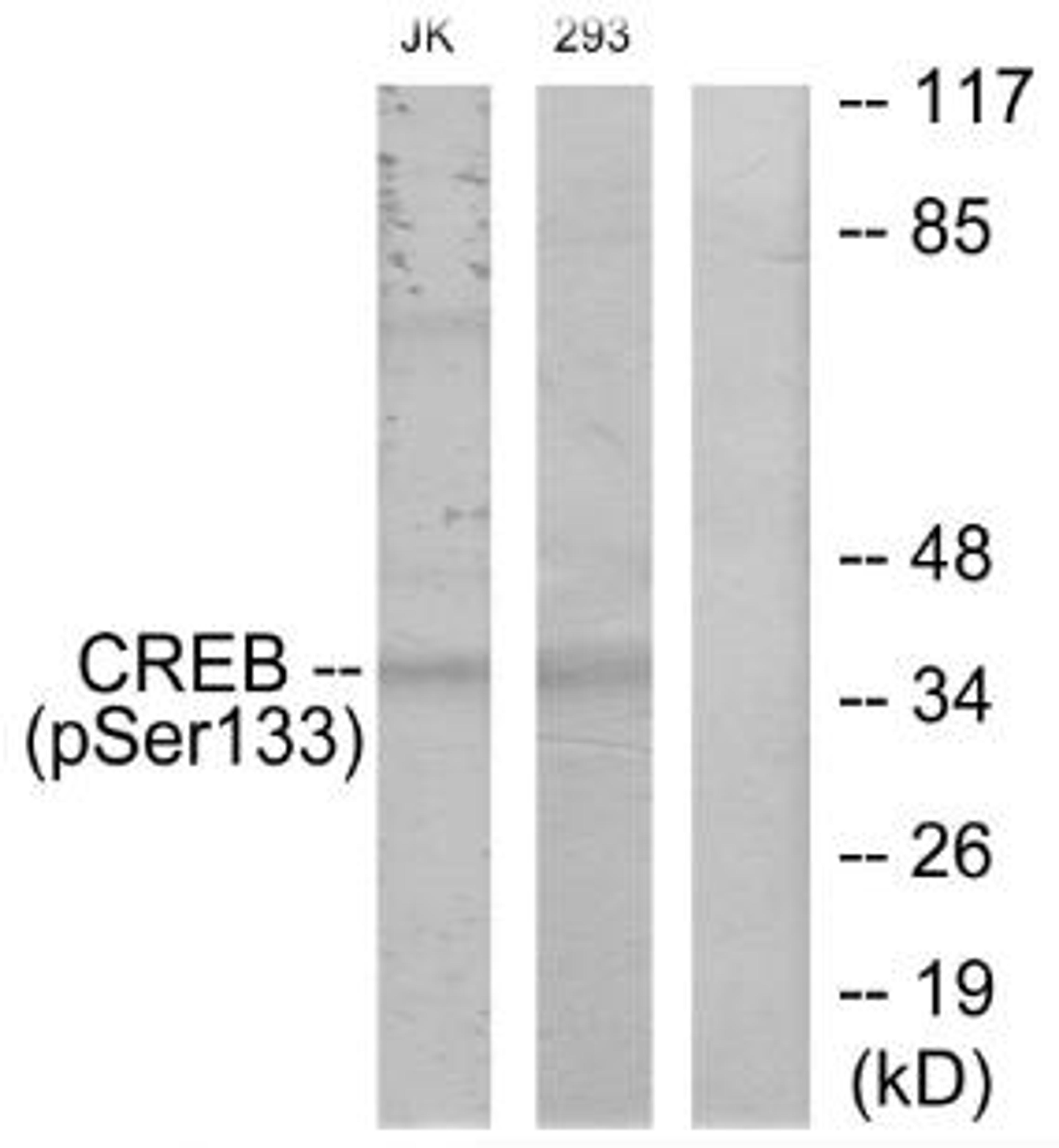 Western blot analysis of JK cells and 293 cells using CREB (phospho-Ser133) antibody.