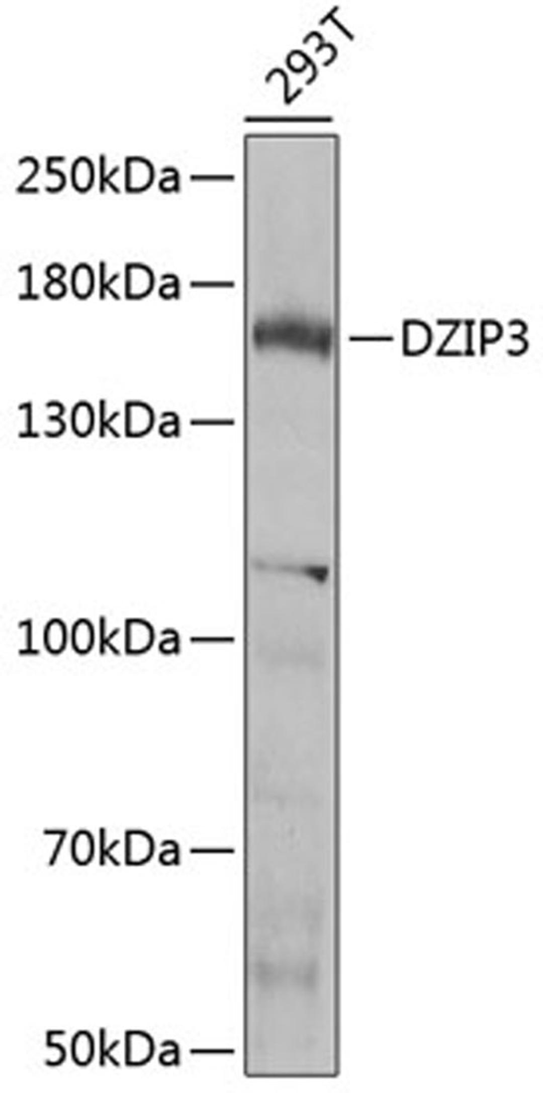 Western blot - DZIP3 Antibody (A7179)