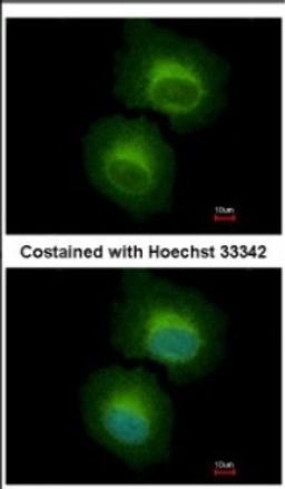 Immunocytochemistry/Immunofluorescence: OASL Antibody [NBP2-19618] - Immunofluorescence analysis of paraformaldehyde-fixed HeLa, using antibody at 1:500 dilution.