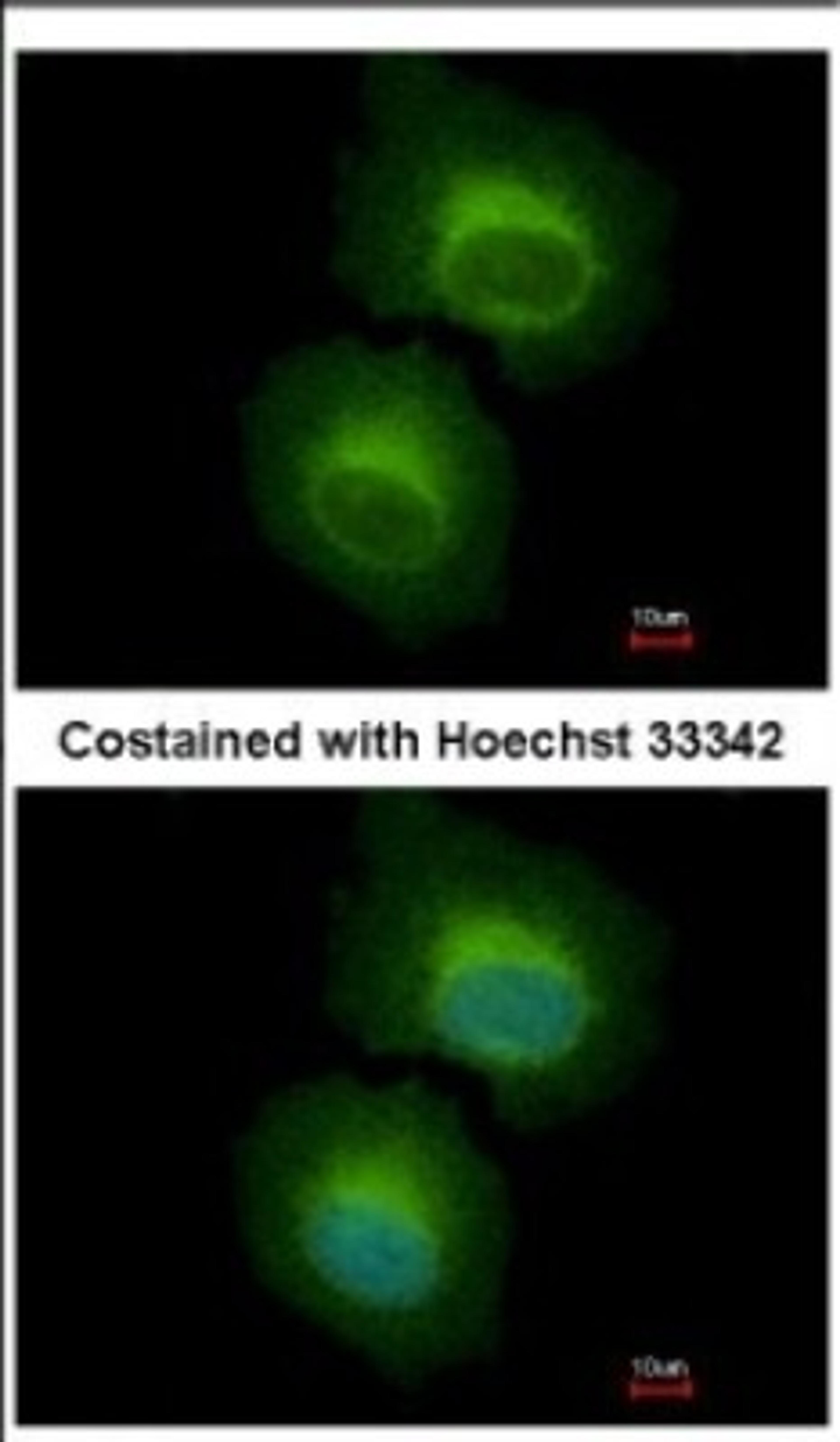 Immunocytochemistry/Immunofluorescence: OASL Antibody [NBP2-19618] - Immunofluorescence analysis of paraformaldehyde-fixed HeLa, using antibody at 1:500 dilution.