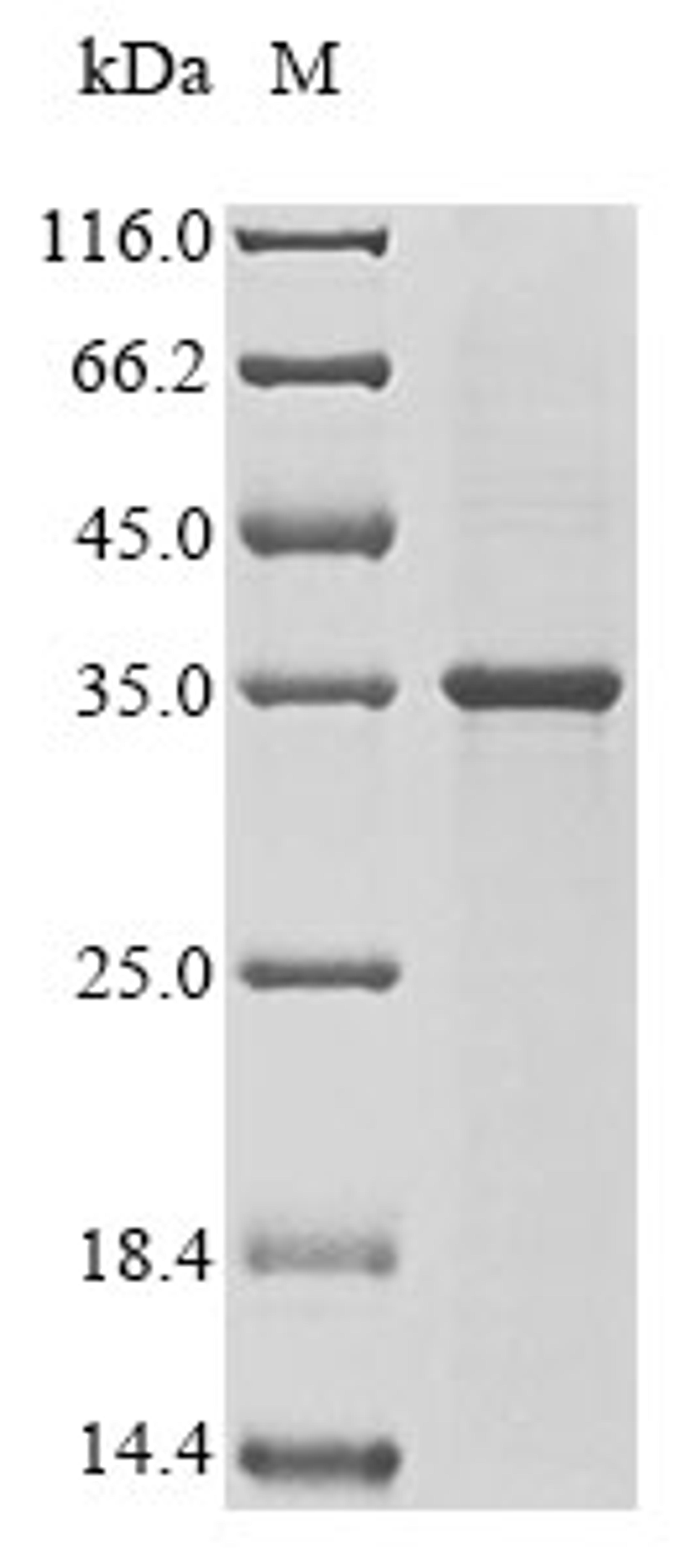 (Tris-Glycine gel) Discontinuous SDS-PAGE (reduced) with 5% enrichment gel and 15% separation gel.