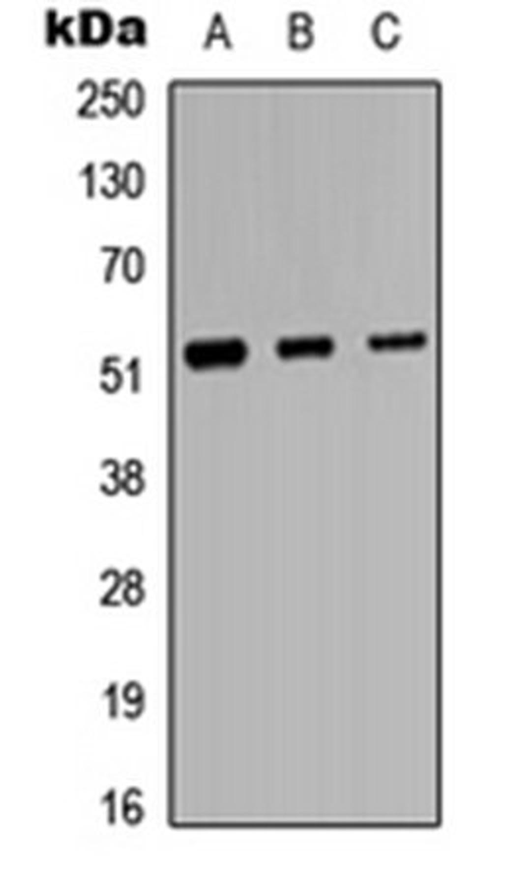 Western blot analysis of HeLa (Lane 1), Raw264.7 (Lane 2), H9C2 (Lane 3) whole cell lysates using Protein C antibody