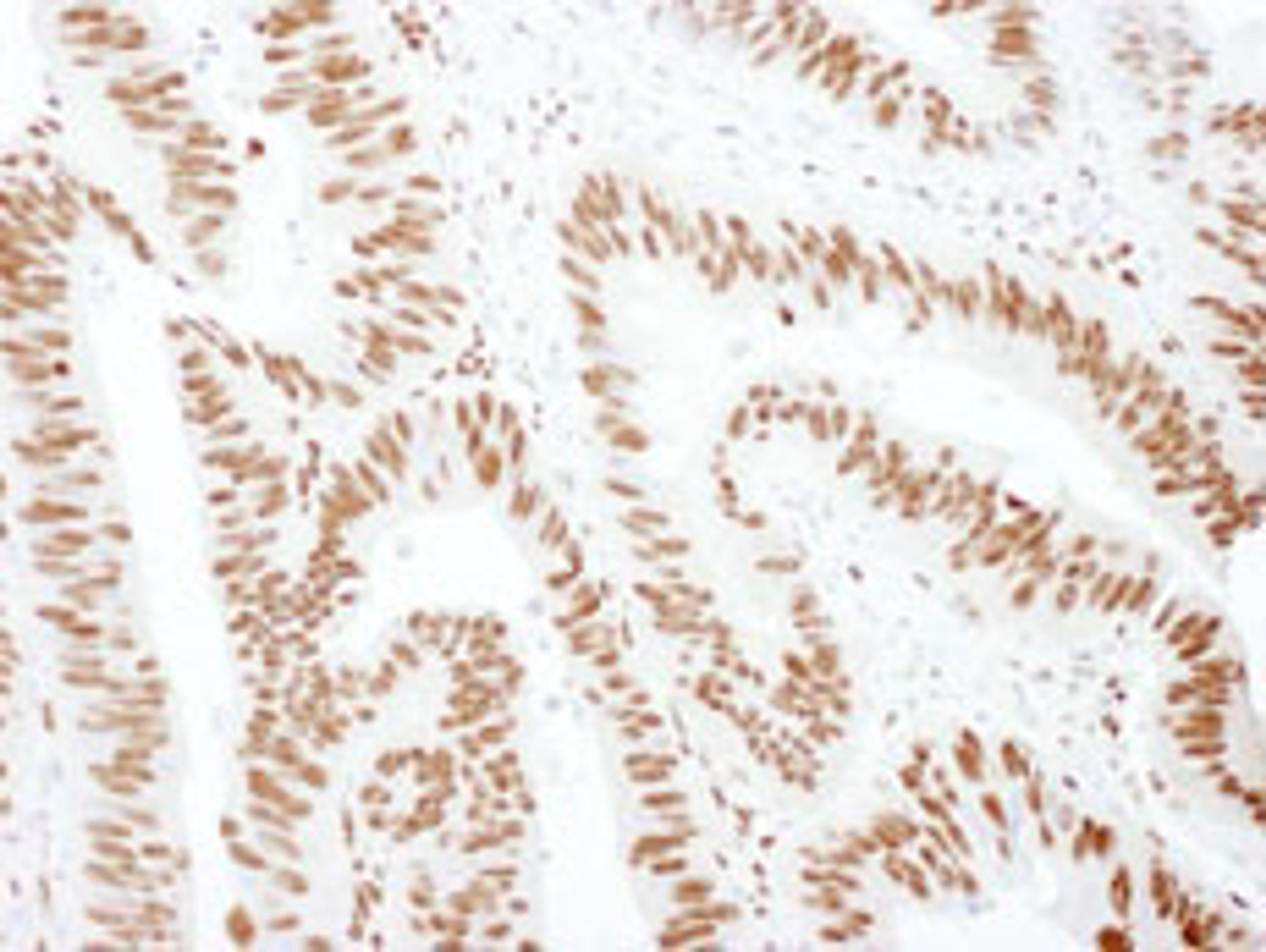 Detection of human hnRNP M3/4 by immunohistochemistry.