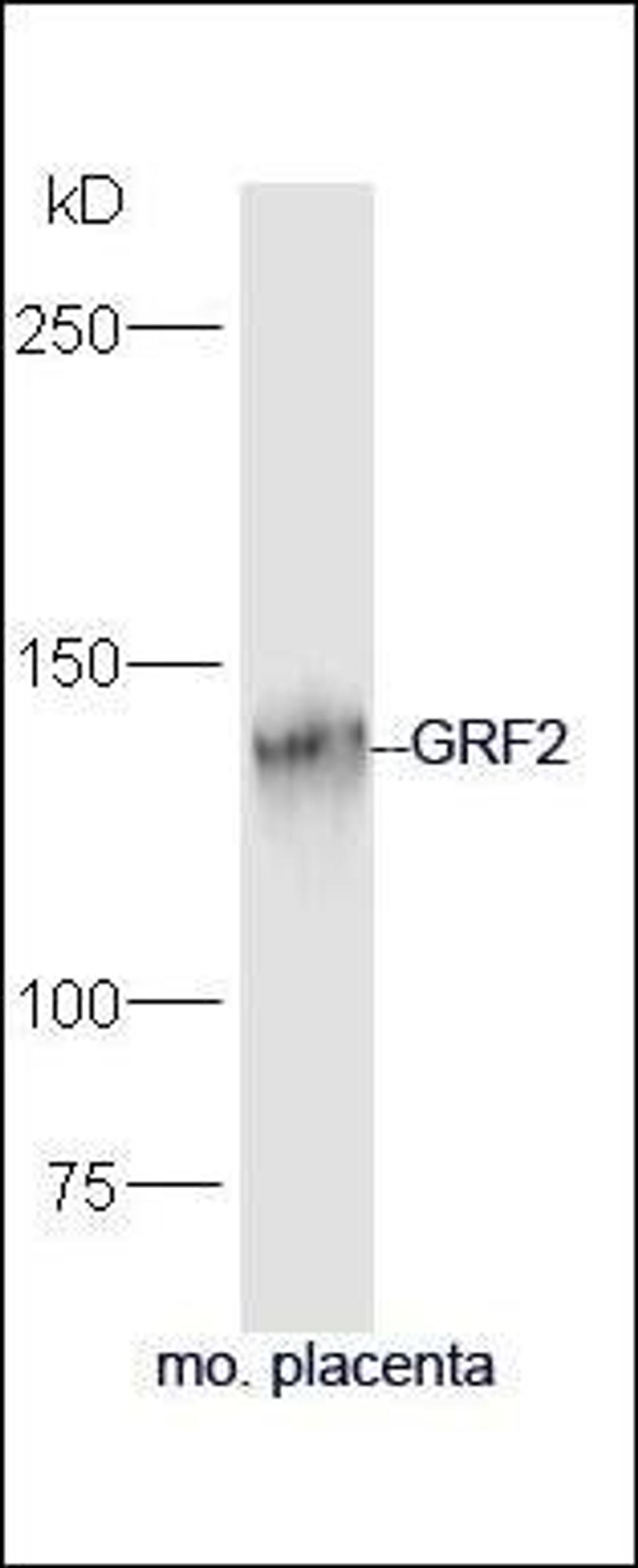 Western blot analysis of mouse placenta lysate using GRF2 antibody.