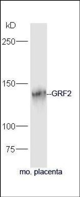 Western blot analysis of mouse placenta lysate using GRF2 antibody.