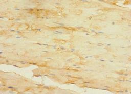 Immunohistochemistry of paraffin-embedded human skeletal muscle tissue using CSB-PA027047LA01HU at dilution of 1:100