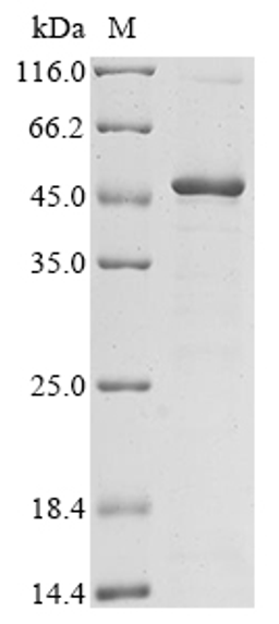 (Tris-Glycine gel) Discontinuous SDS-PAGE (reduced) with 5% enrichment gel and 15% separation gel.