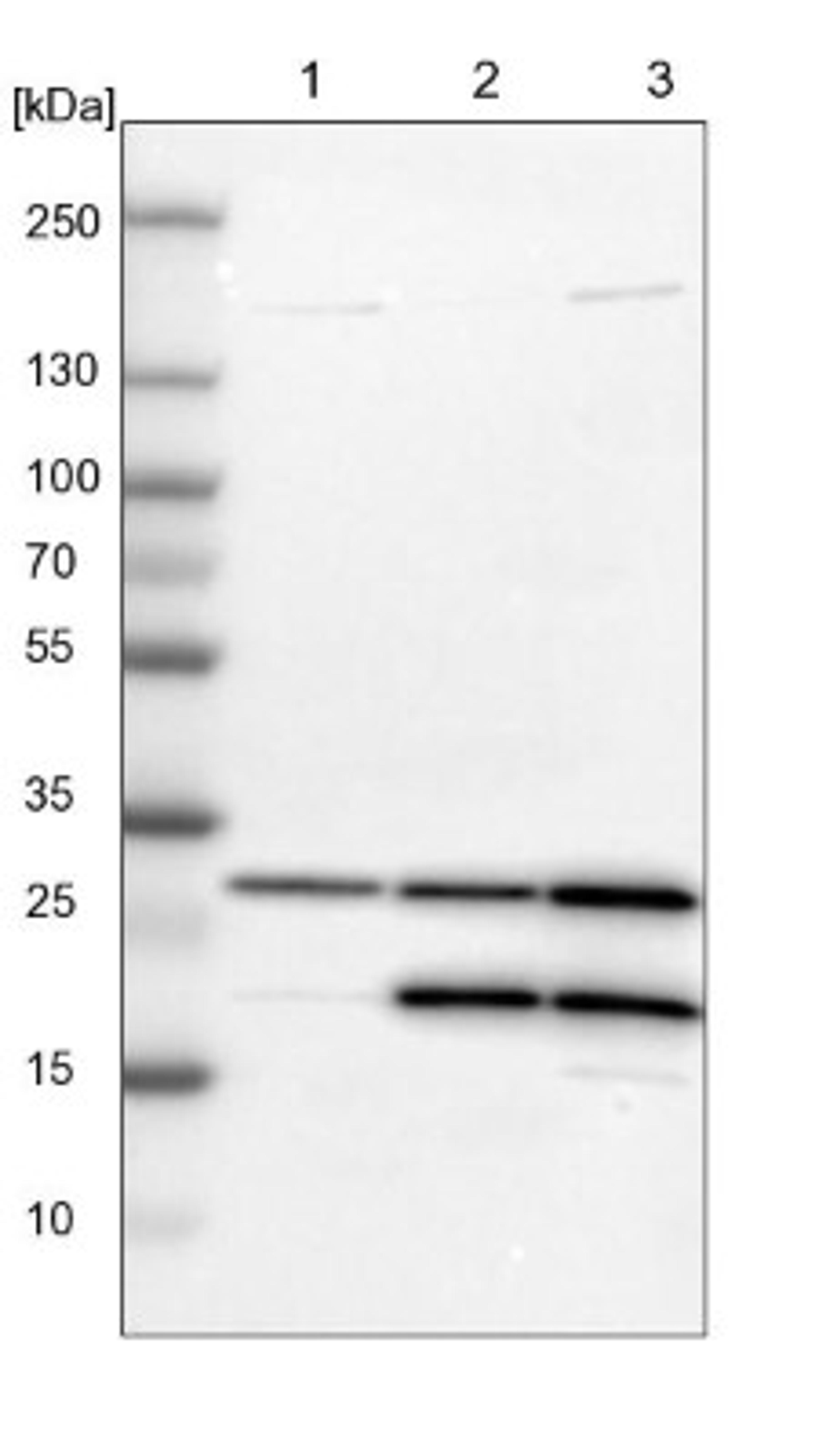 Western Blot: Carbonic Anhydrase III/CA3 Antibody [NBP1-88229] - Lane 1: NIH-3T3 cell lysate (Mouse embryonic fibroblast cells)<br/>Lane 2: NBT-II cell lysate (Rat Wistar bladder tumour cells)<br/>Lane 3: PC12 cell lysate (Pheochromocytoma of rat adrenal medulla)