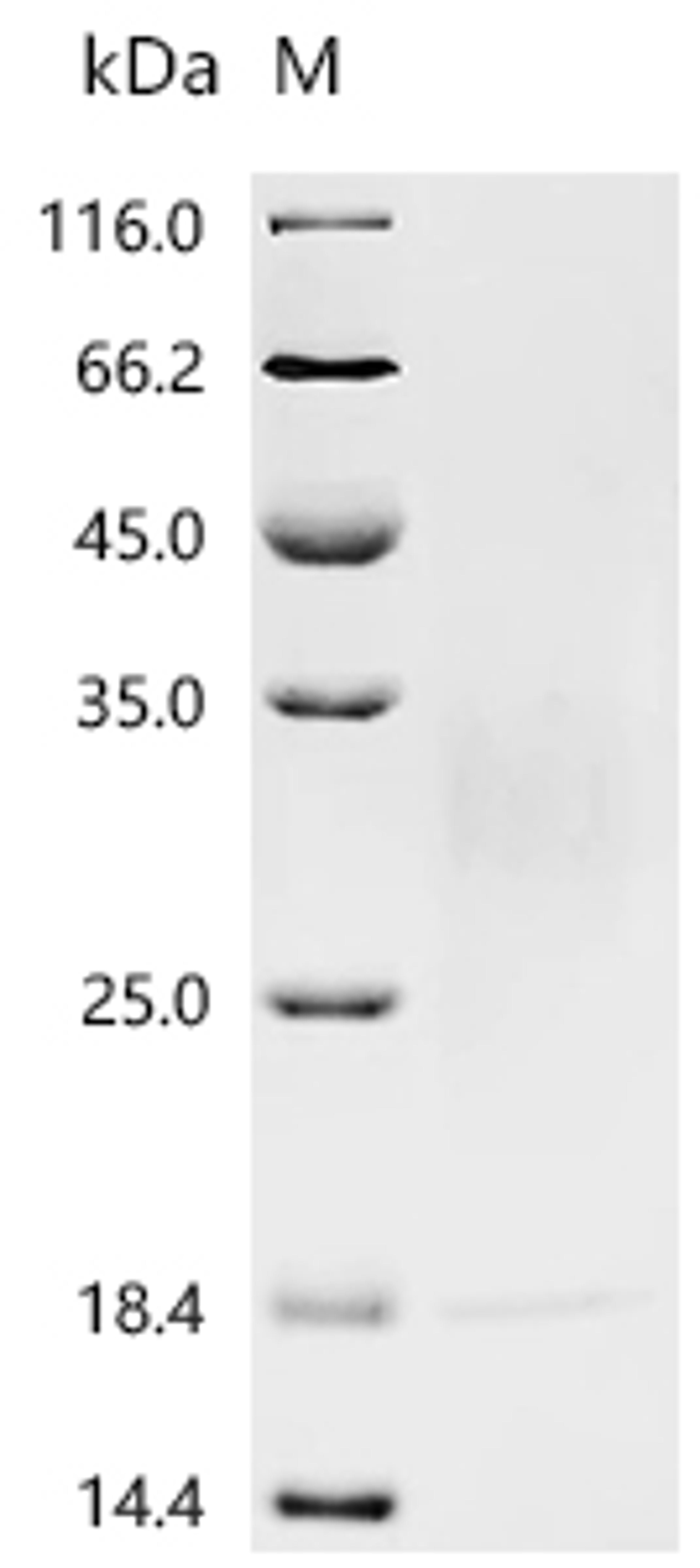 (Tris-Glycine gel) Discontinuous SDS-PAGE (reduced) with 5% enrichment gel and 15% separation gel.
