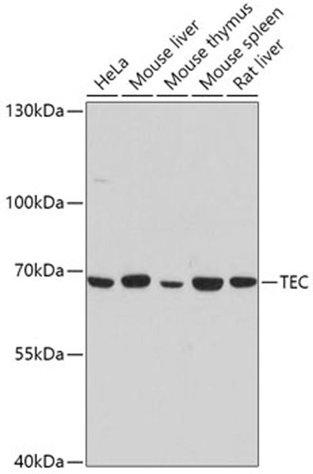 Western blot - TEC antibody (A0189)