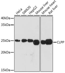 Western blot - CLPP Rabbit mAb (A3214)