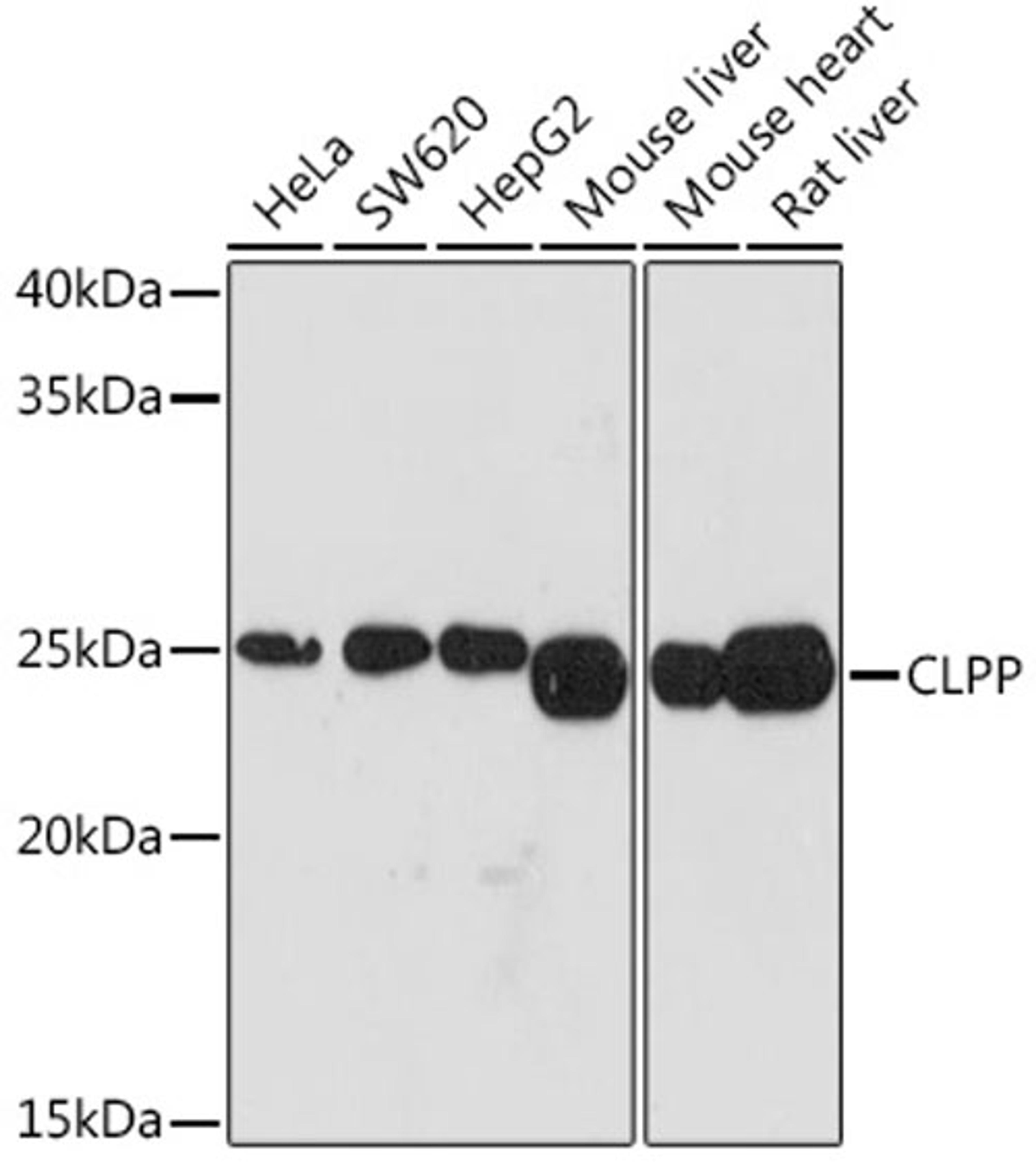 Western blot - CLPP Rabbit mAb (A3214)