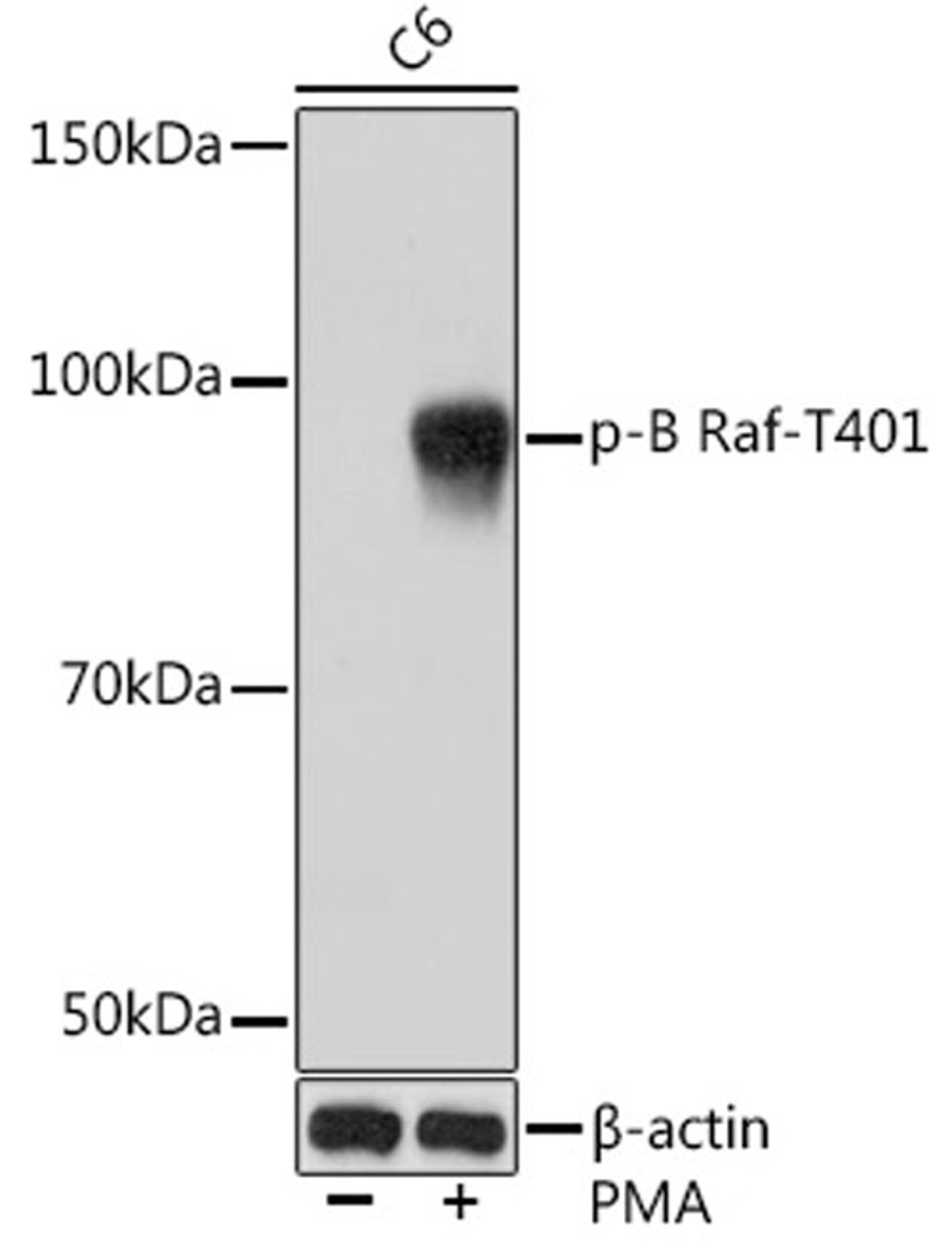 Western blot - Phospho-B Raf-T401 Rabbit mAb (AP1041)