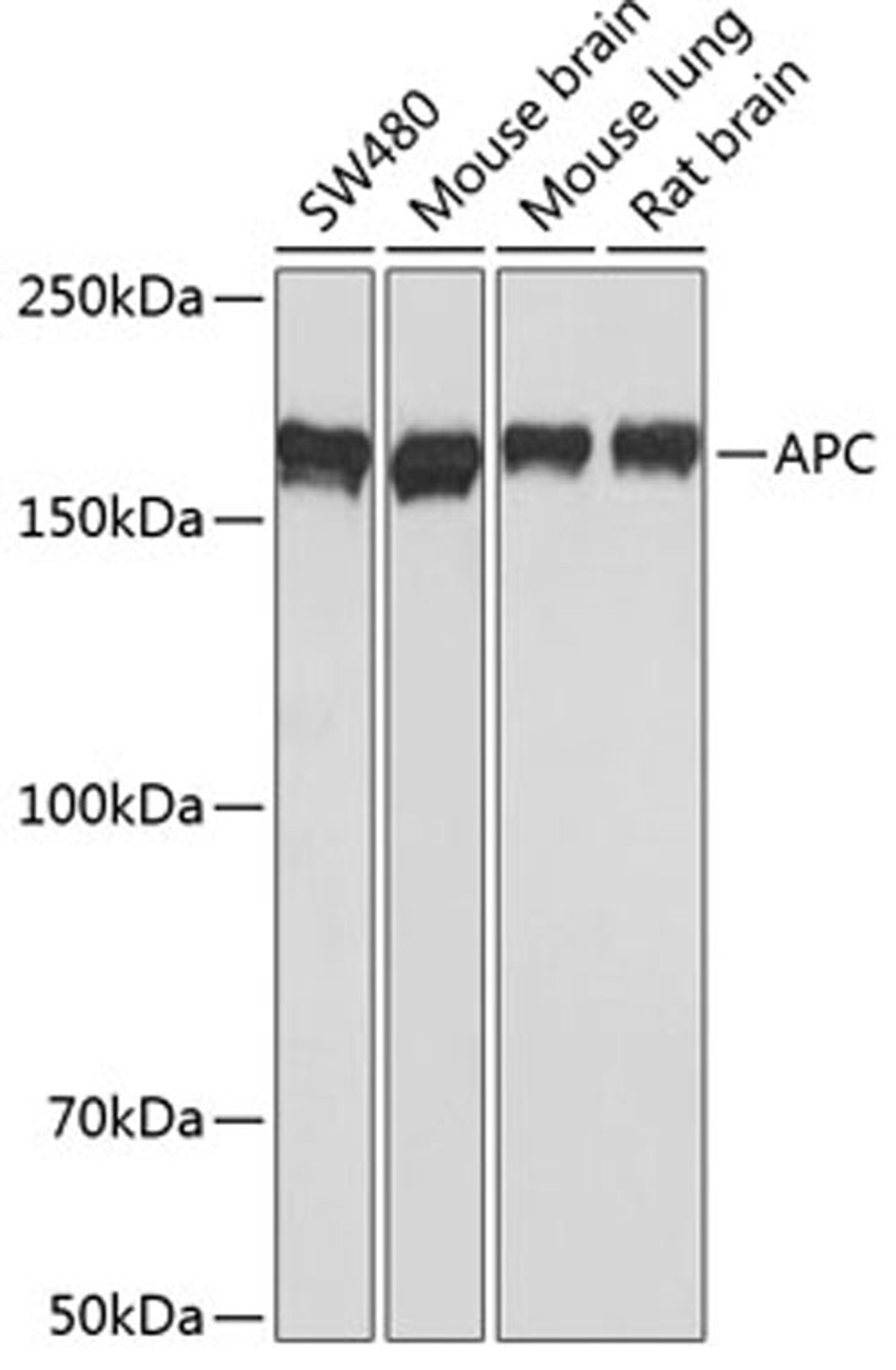 Western blot - APC antibody (A17912)