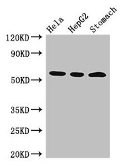 Western Blot. Positive WB detected in: Hela whole cell lysate, HepG2 whole cell lysate, Mouse stomach tissue. All lanes: MDM4 antibody at 3µg/ml. Secondary. Goat polyclonal to rabbit IgG at 1/50000 dilution. Predicted band size: 55, 15, 14, 19, 50 kDa. Observed band size: 55 kDa